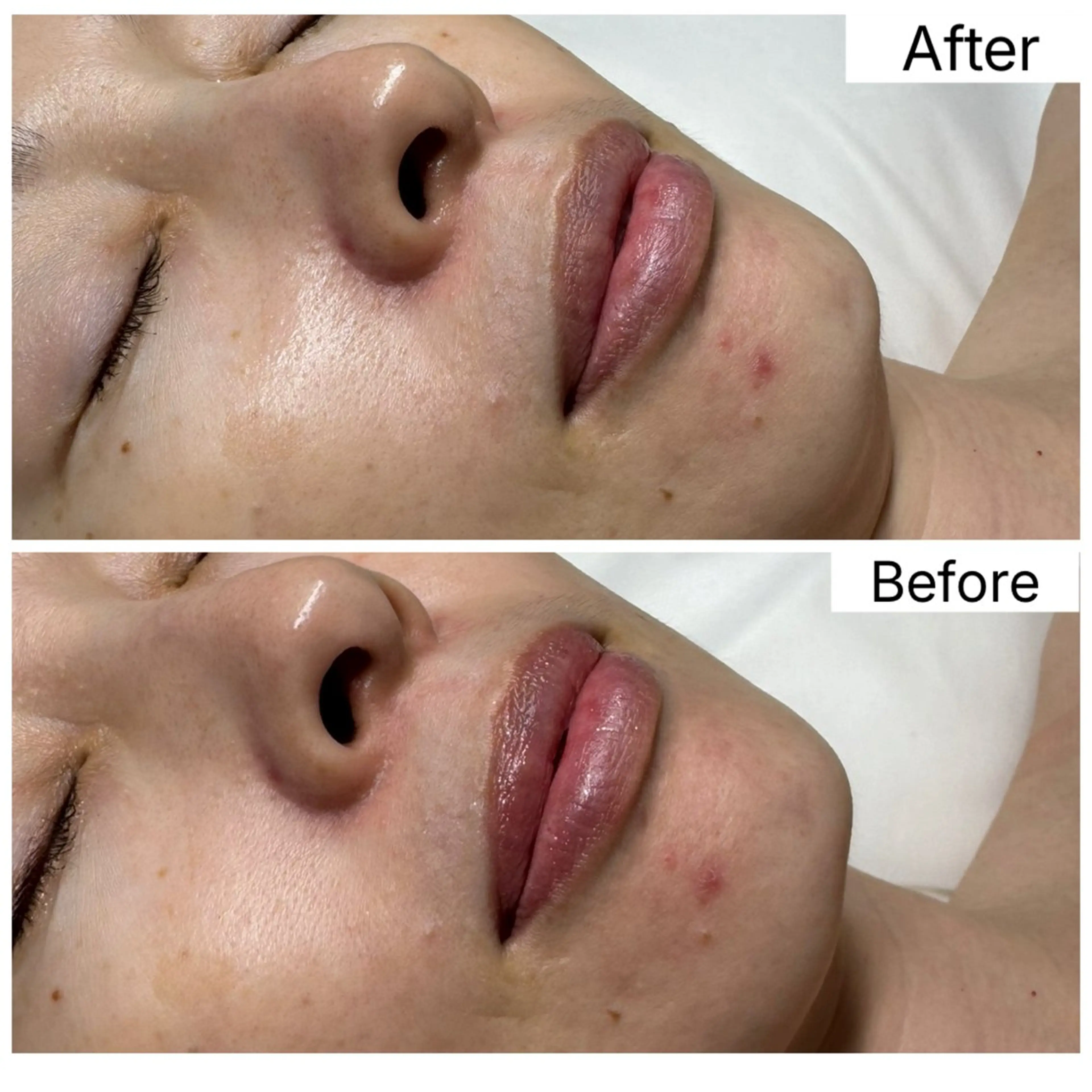 エステ Hémireve Shirokane所属・トロイアルケ🩵 美眉EMIのエステ・リラクイメージ