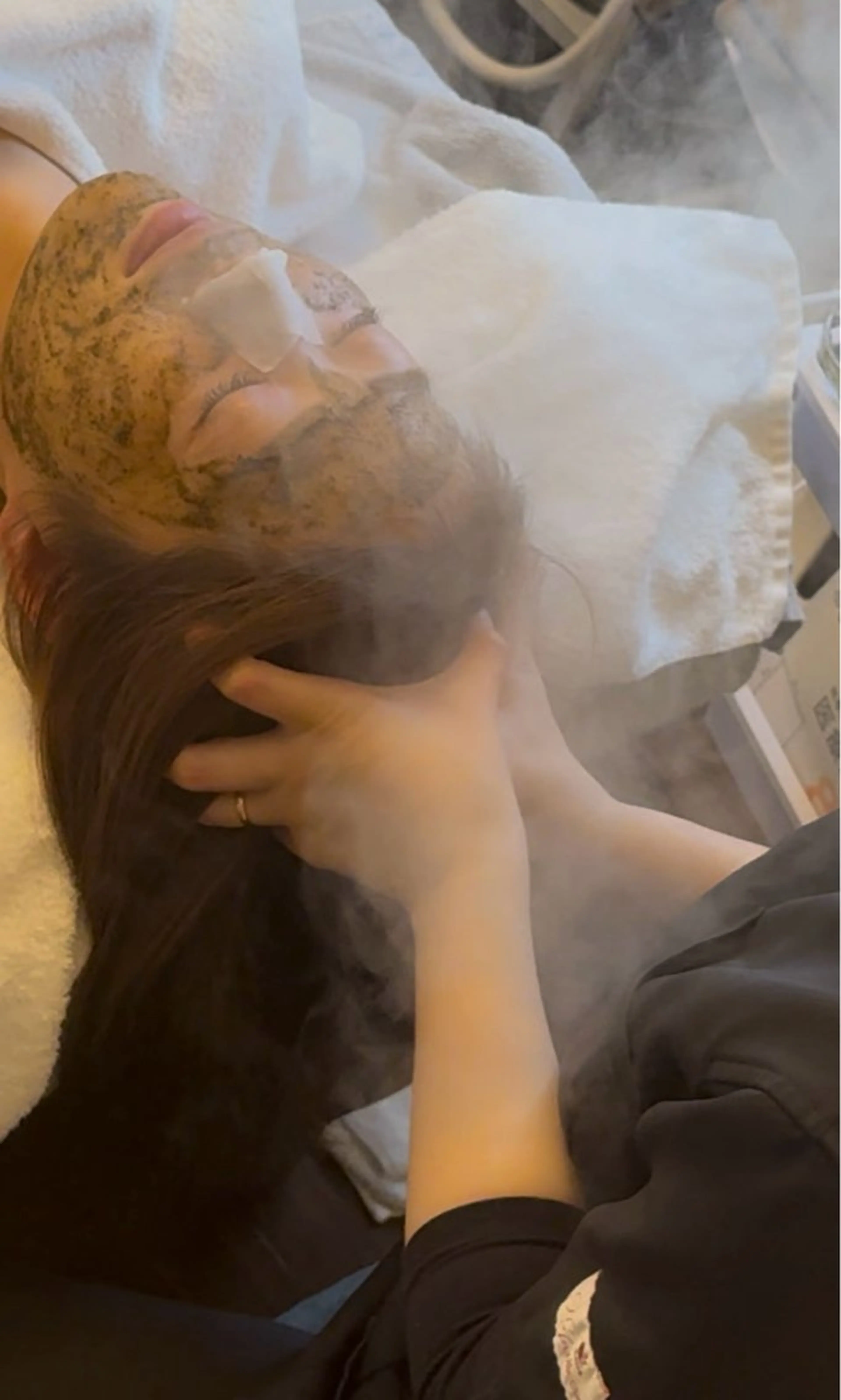 ハーブピーリング【剥離なし】50%オフ　　　口コミモニターの写真