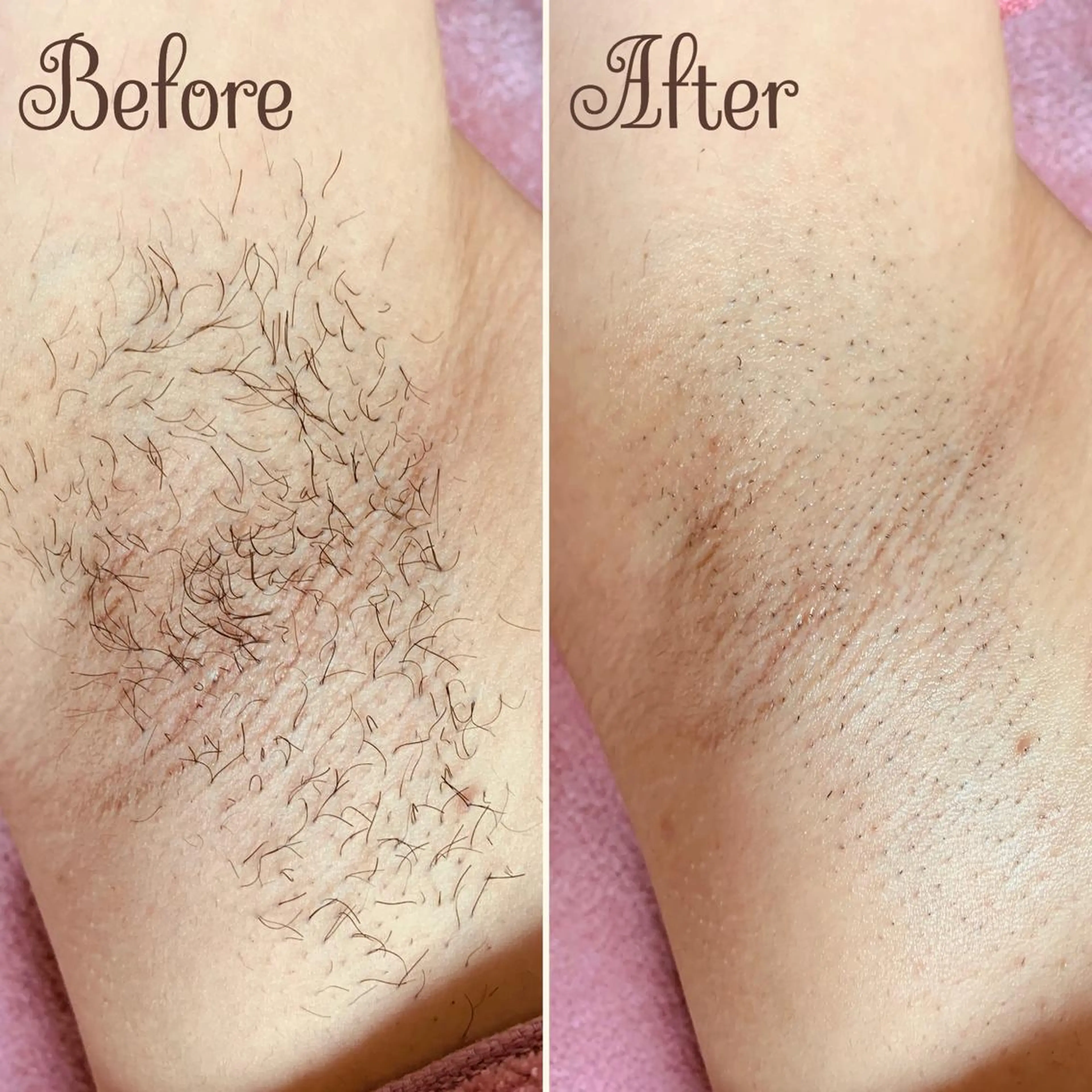 脱毛 透明感の肌Lino malieのエステ・リラクイメージ