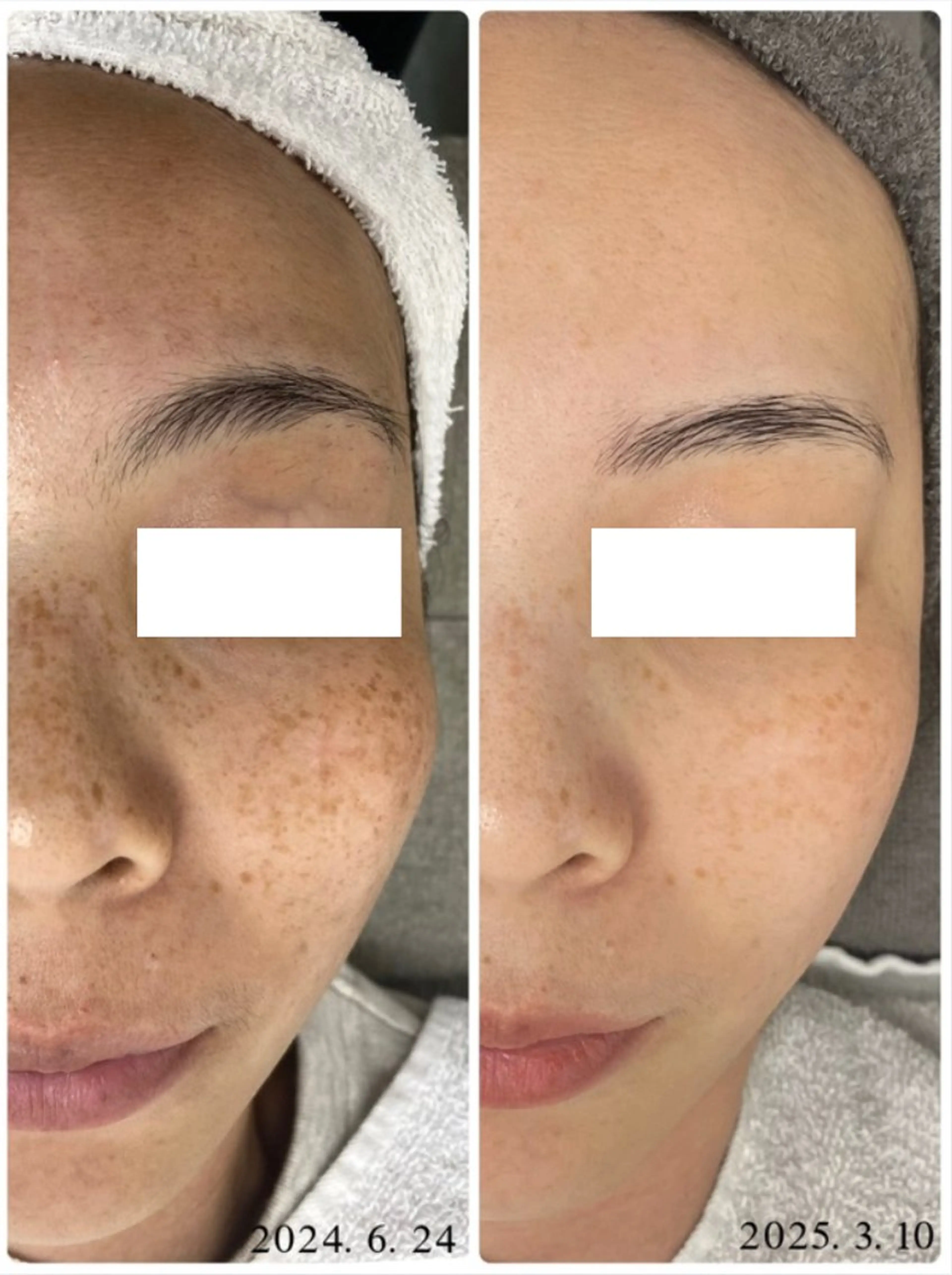 メンズ クリニカルWHITEケア豊見城所属・えだ すがこのエステ・リラクイメージ