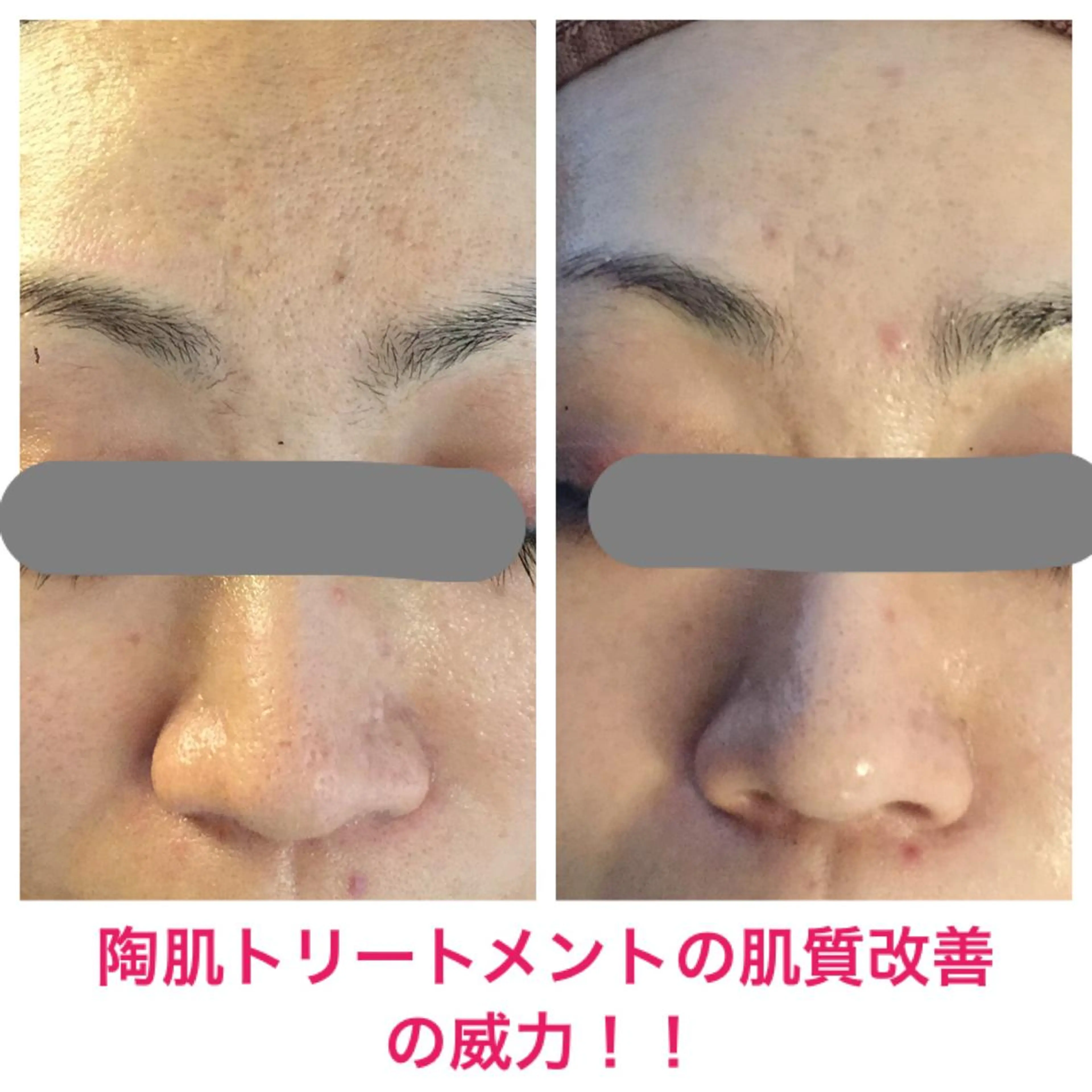 痩身専門サロン ビューティーグランツのエステ・リラクイメージ