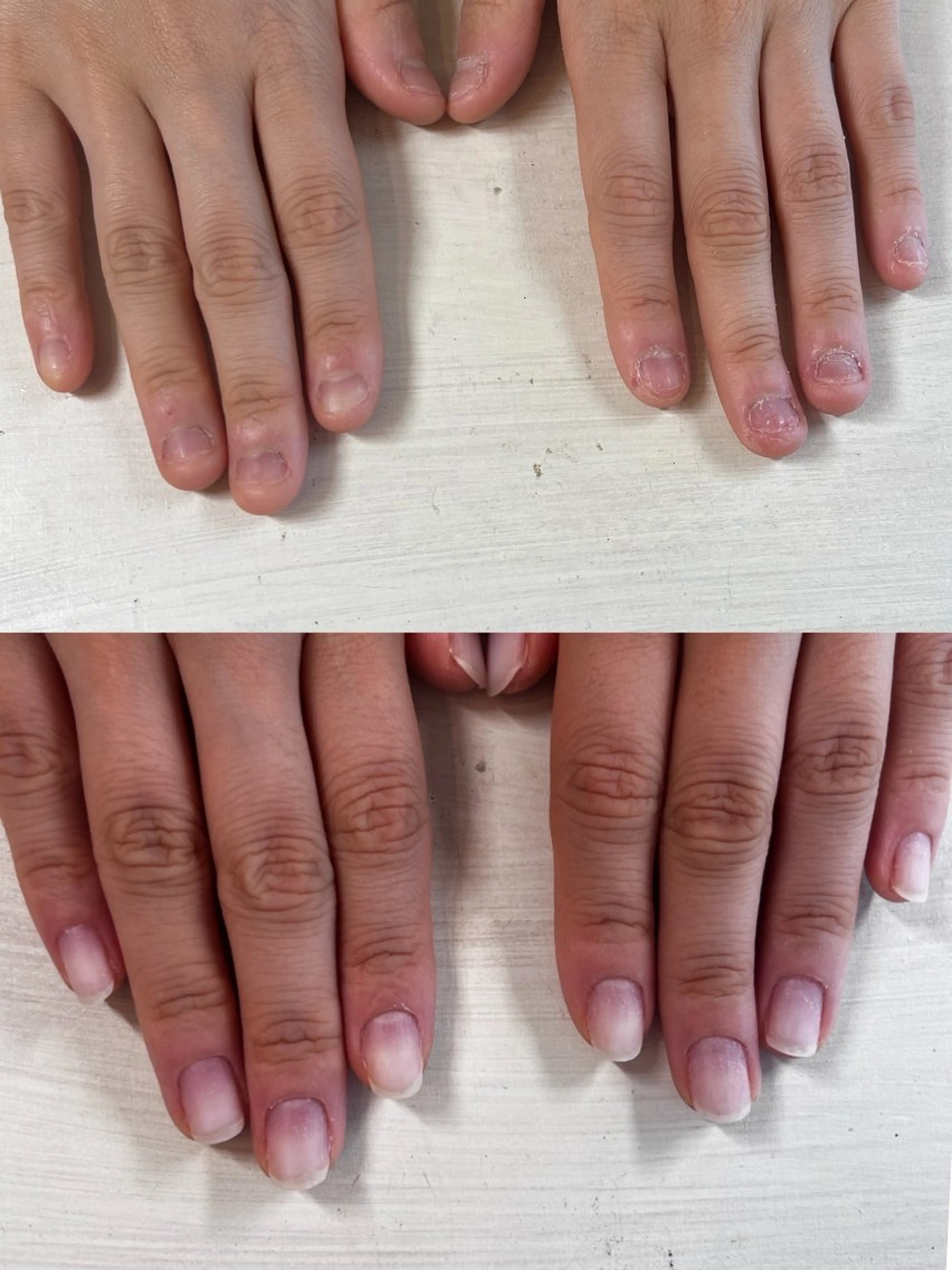 ネイル ピンク 深爪矯正・自爪育成 ヴェールリムのネイルデザイン