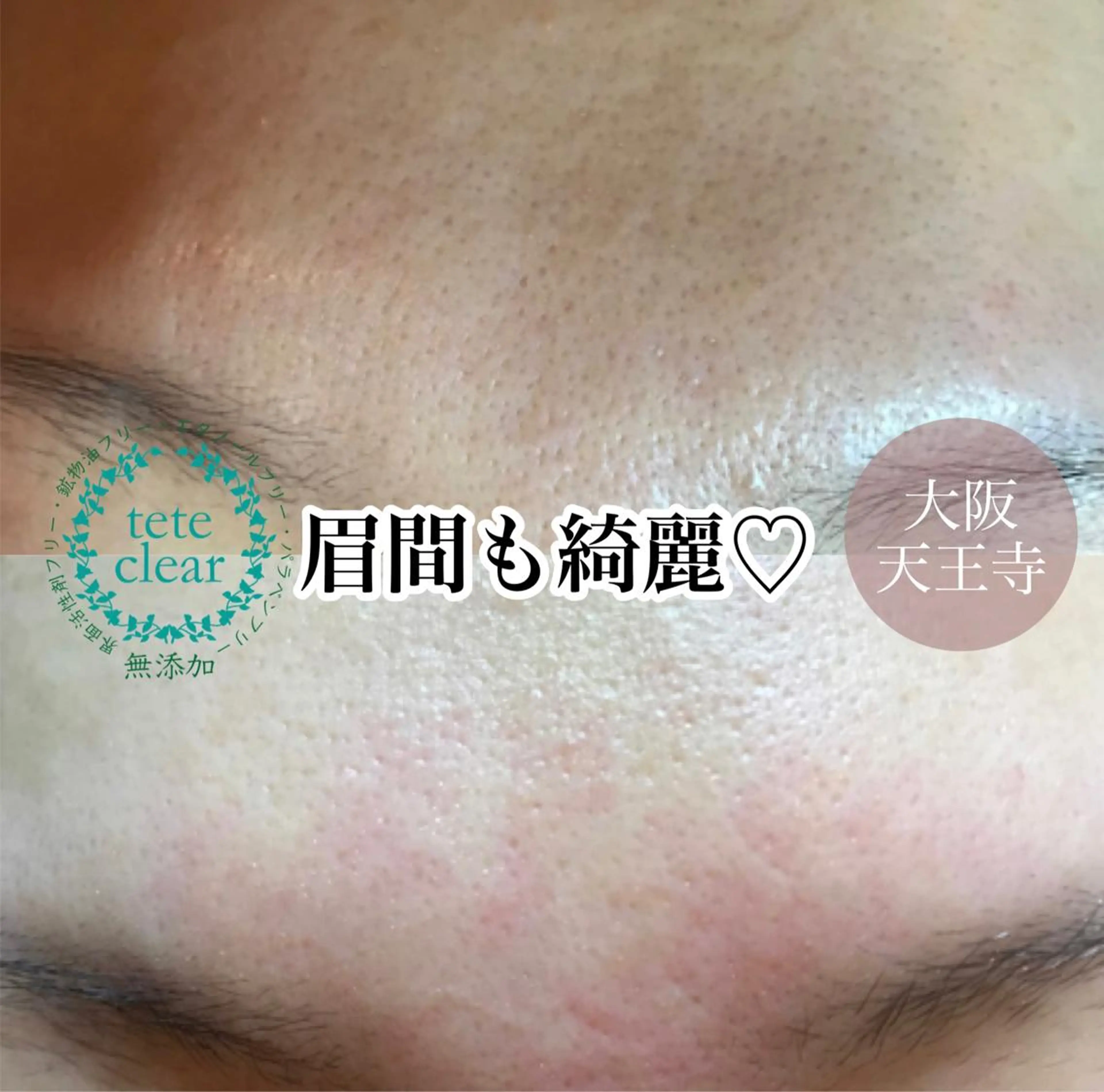 ミディアム マツエク・マツパ 【しみ毛穴専門店】beautysalon Ankh所属・しみ毛穴専門店 Ankh 平田のエステ・リラクイメージ