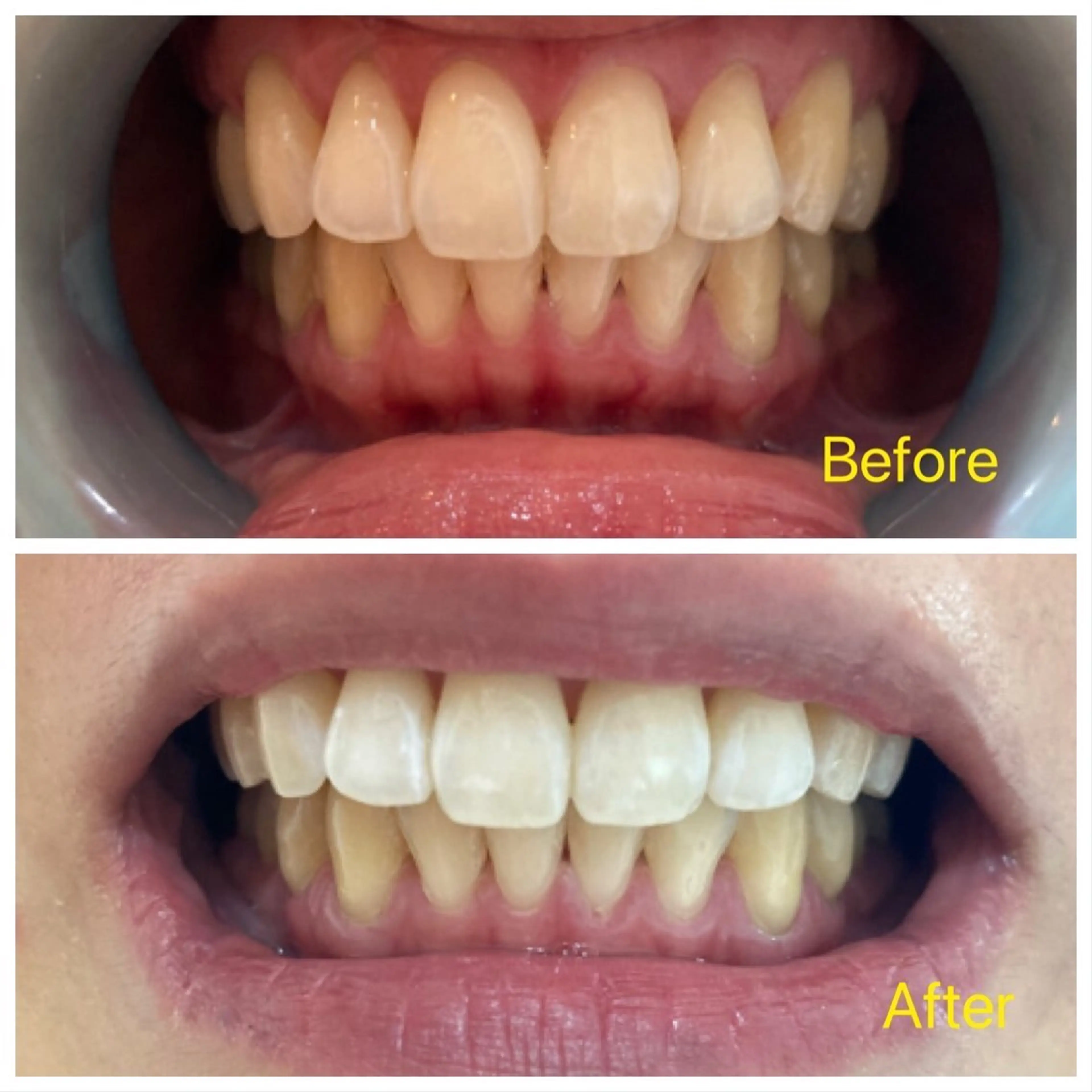 M渋谷店所属・Ｍ渋谷 ホワイトニングのエステ・リラクイメージ