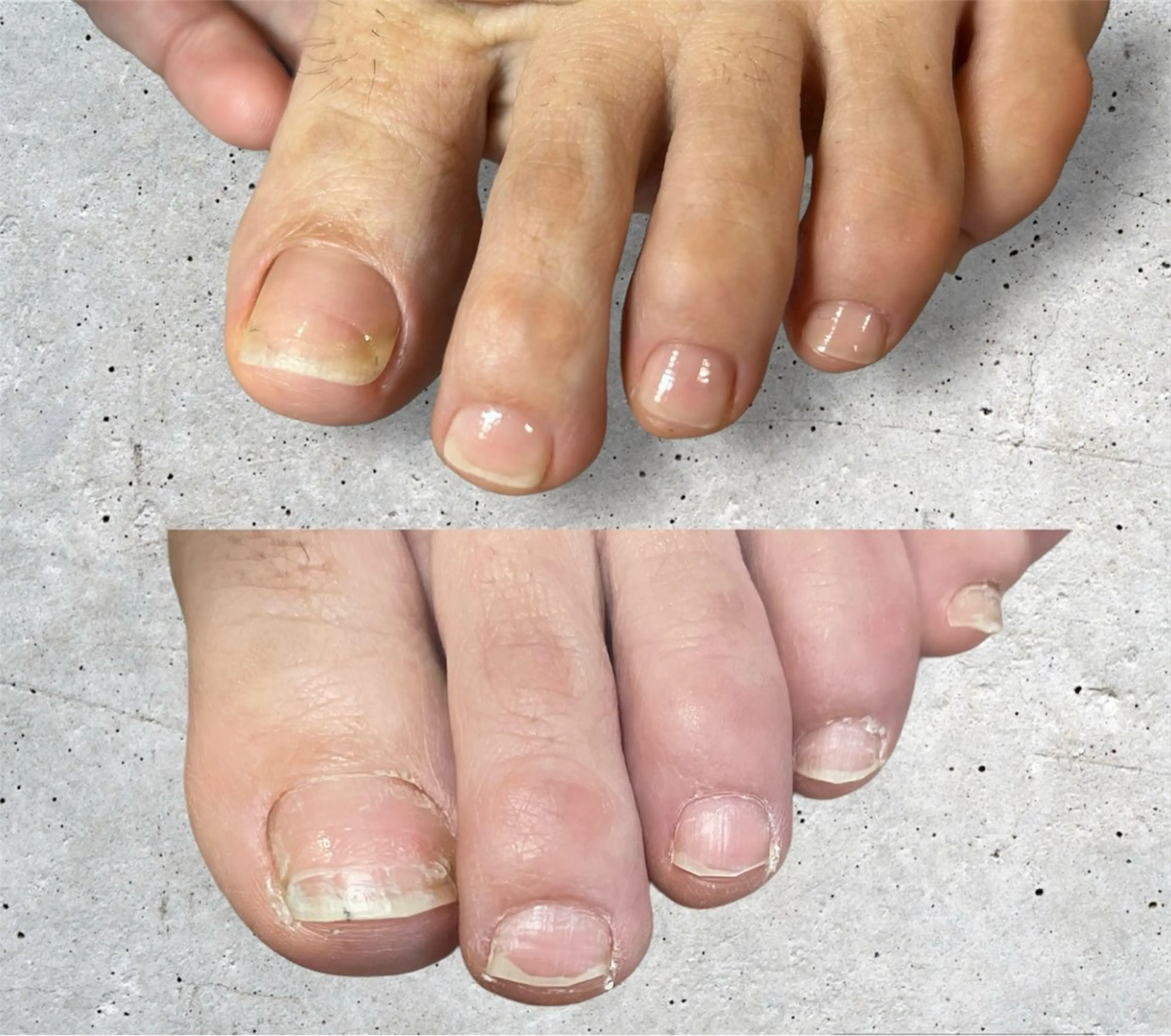 【スペシャルクーポン】 Foot/ケア贅沢フルコースの写真