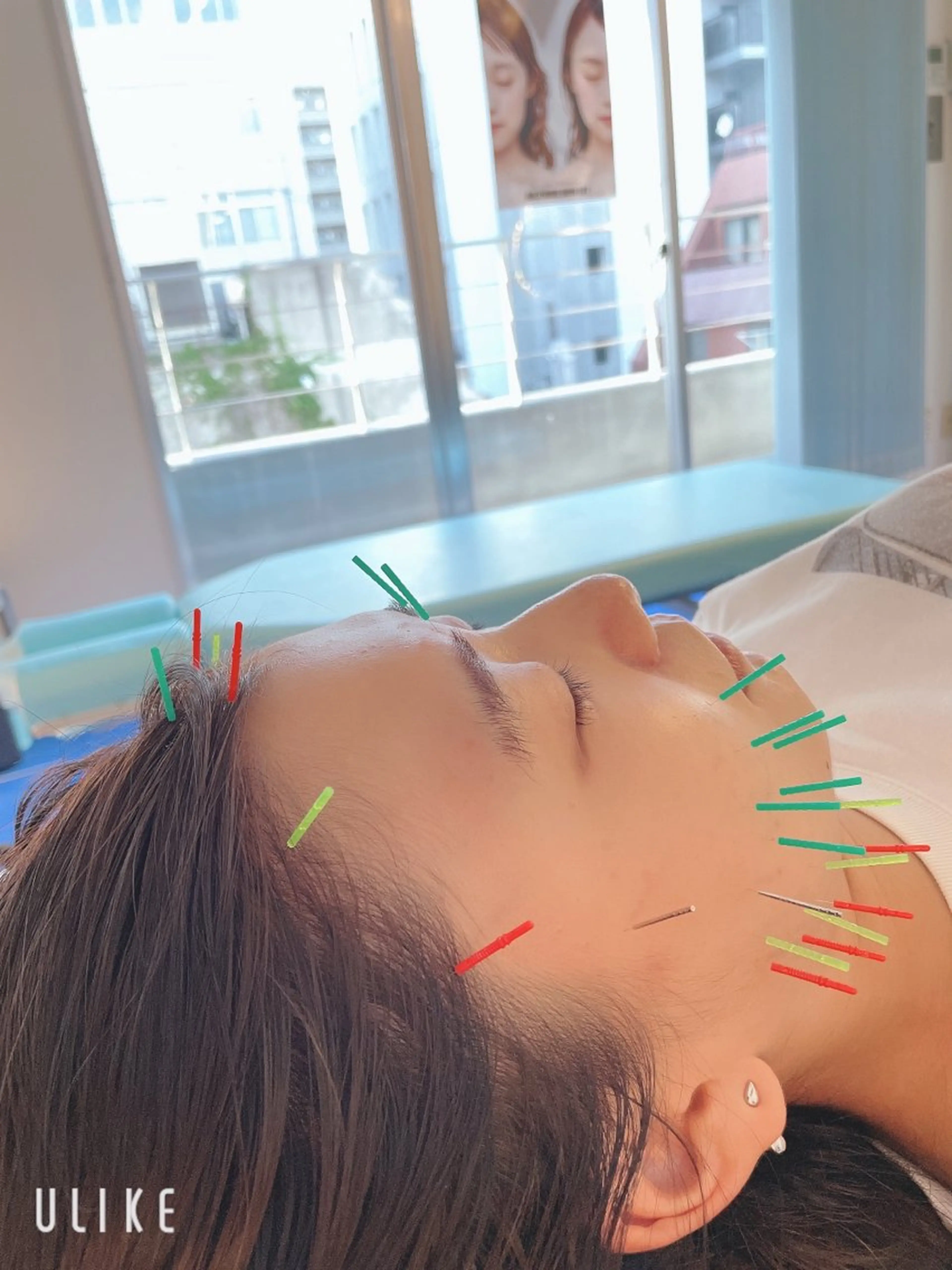 エステ リラク 小顔美容鍼専門サロン 渋谷YZのエステ・リラクイメージ