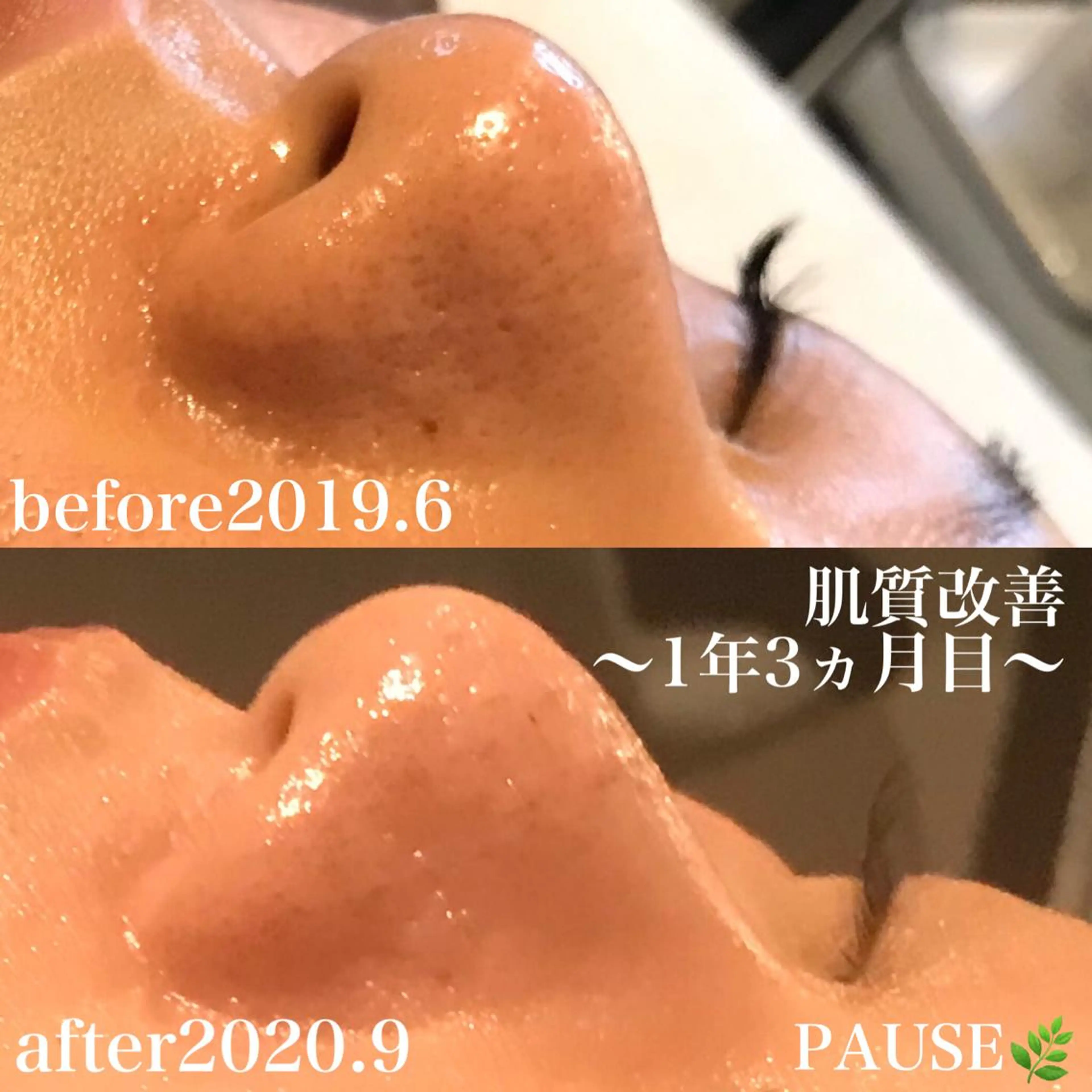 エステ 浜野 恵美のエステ・リラクイメージ