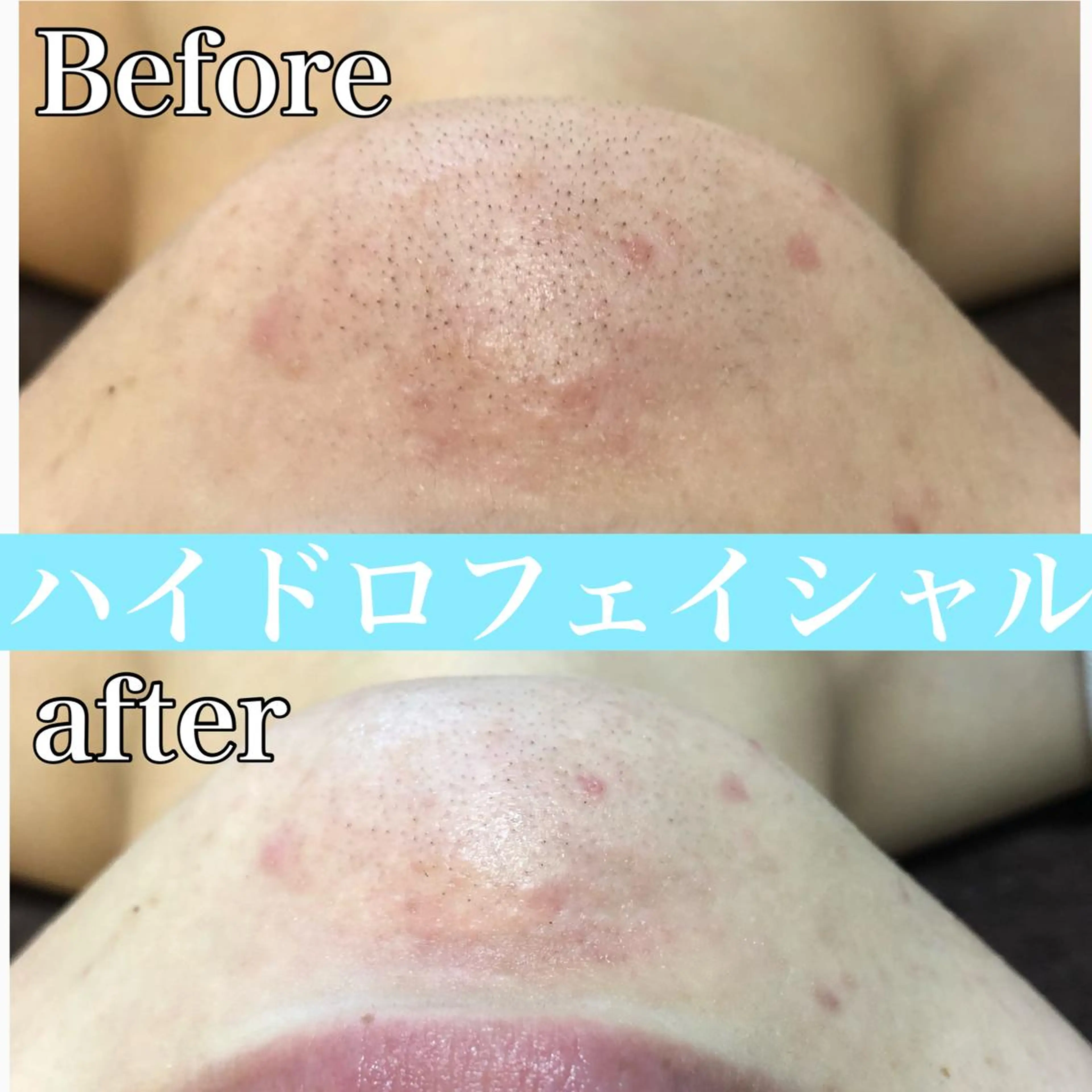 エステ 美肌脱毛と癒しのﾌﾟﾗｲﾍﾞｰﾄｻﾛﾝ。gratia~ｸﾞﾚｲﾃｨｱ~所属・gratia ~ｸﾞﾚｲﾃｨｱ~のエステ・リラクイメージ