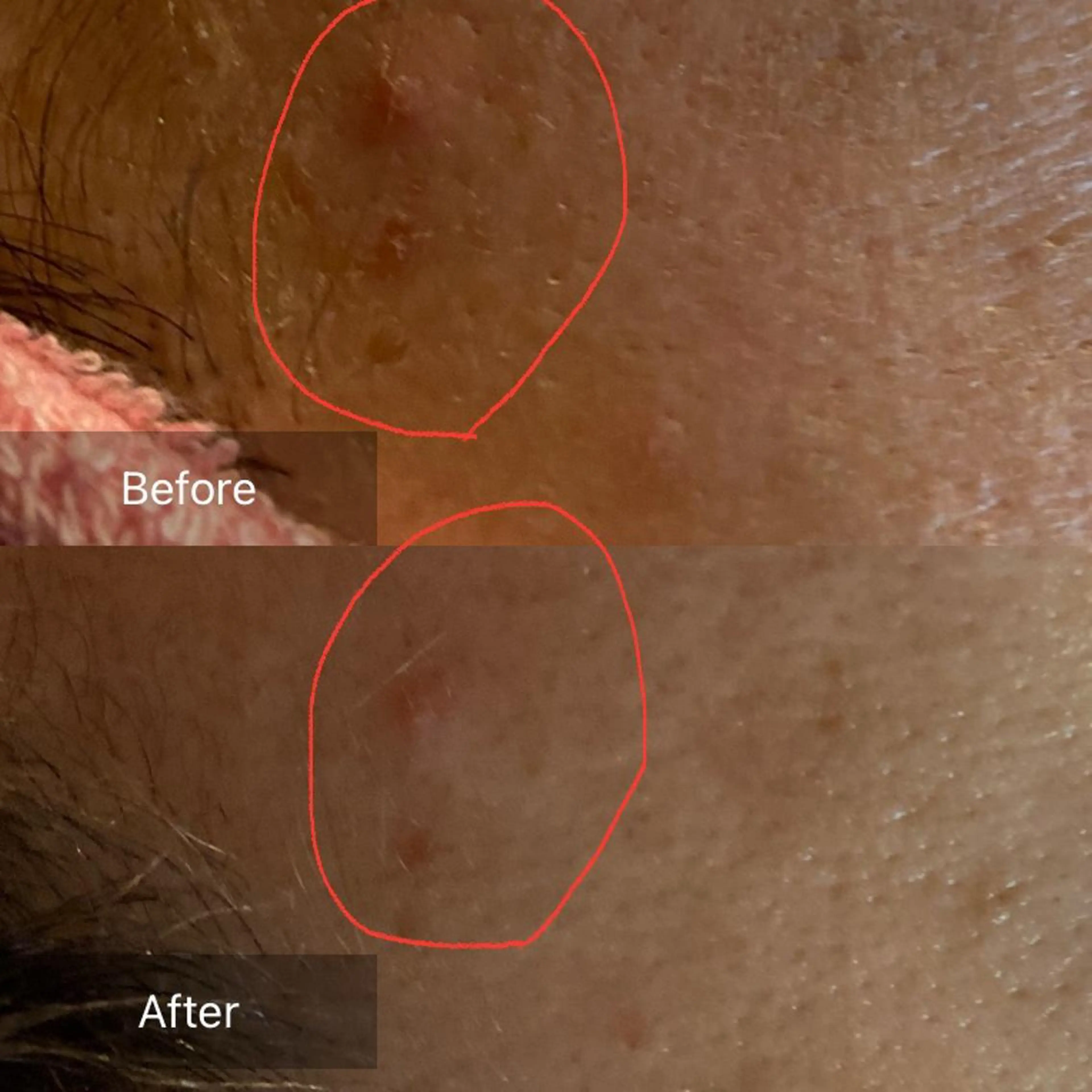 Mandarin Orange所属・毛穴から始める肌メン テマンダリンオレンジのエステ・リラクイメージ