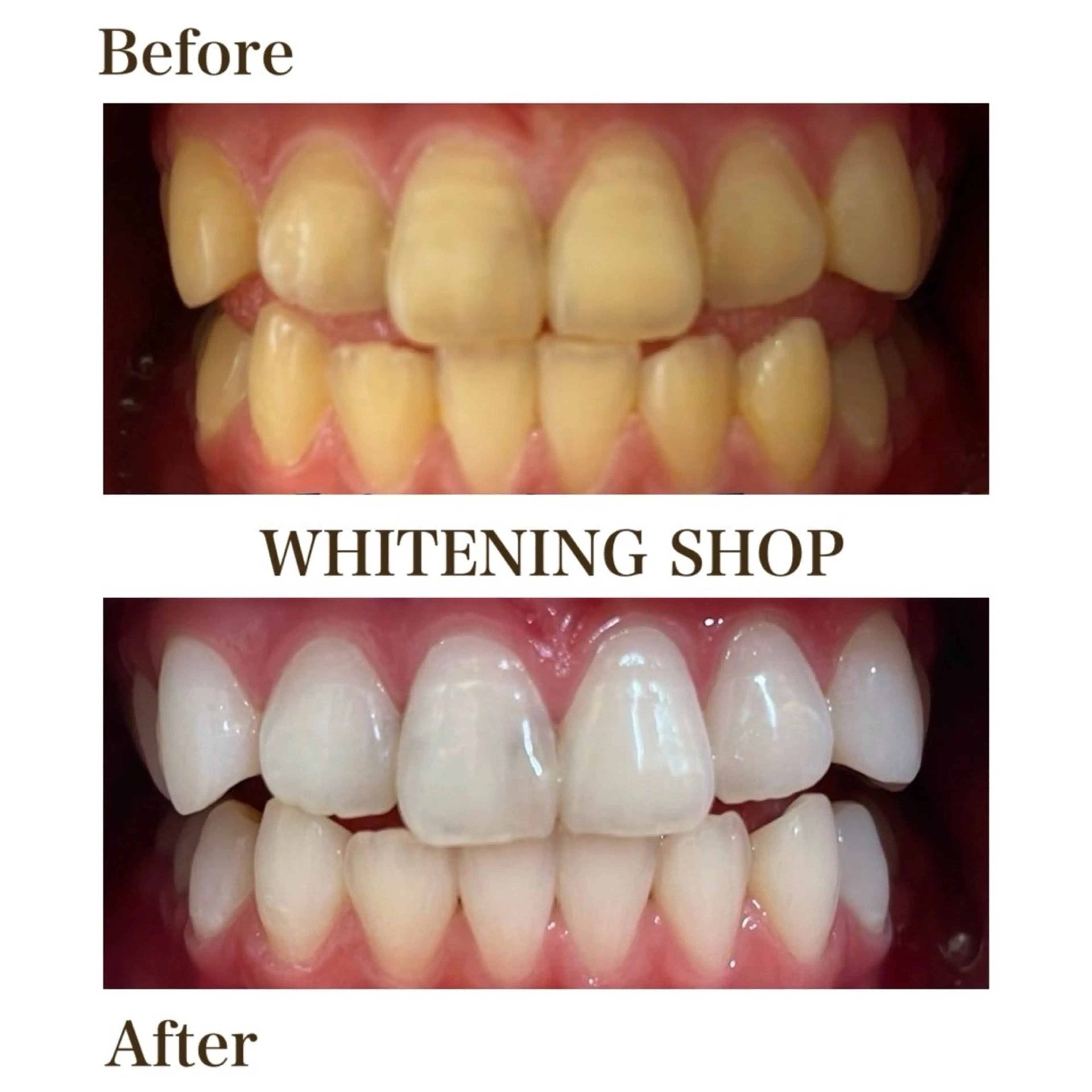 ホワイトニング ショップ銀座7丁目店のその他イメージ