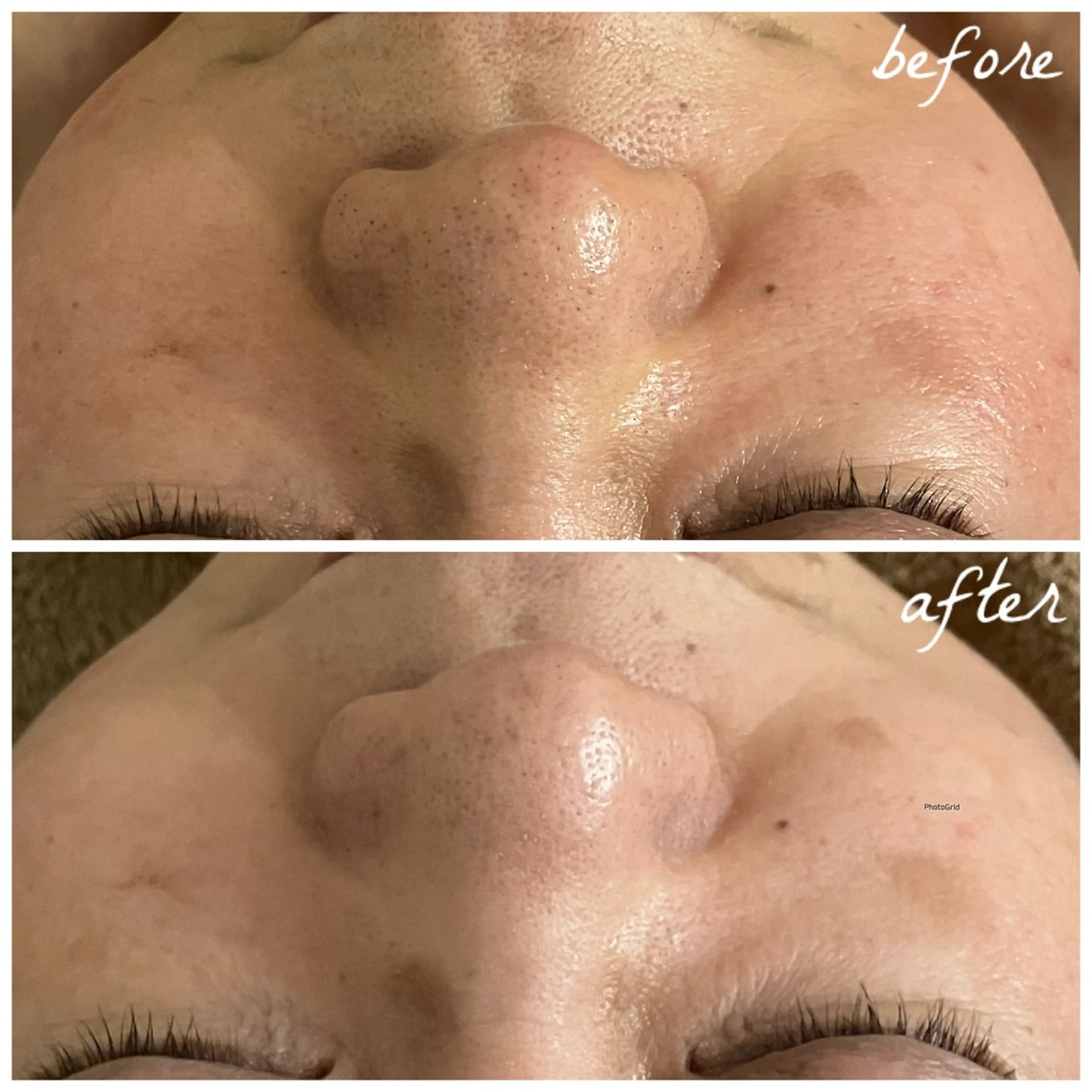 メンズ エステ メナード岐阜茜部 杉浦のエステ・リラクイメージ