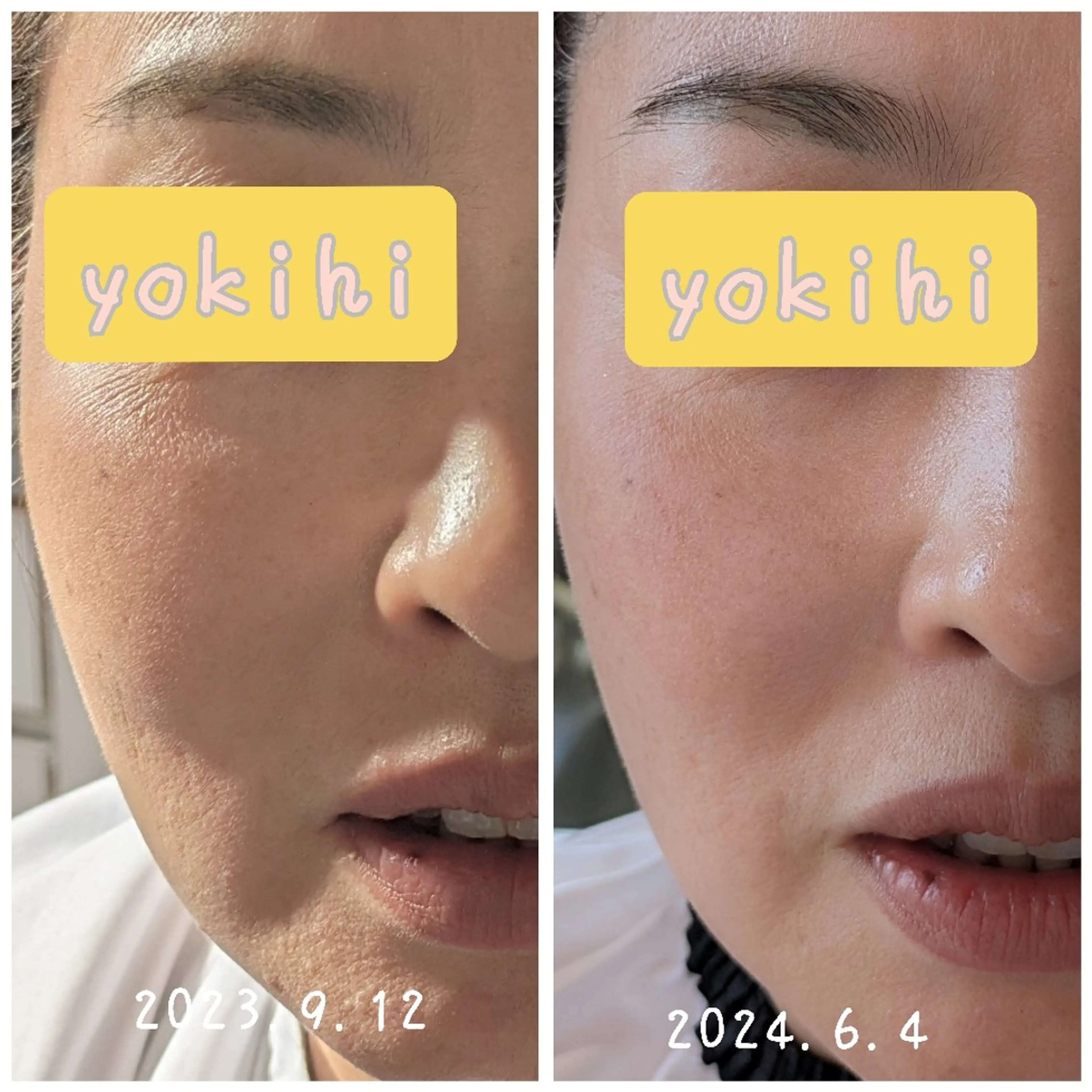 結果が出るスキンケア 肌質改善/まつパのエステ・リラクイメージ