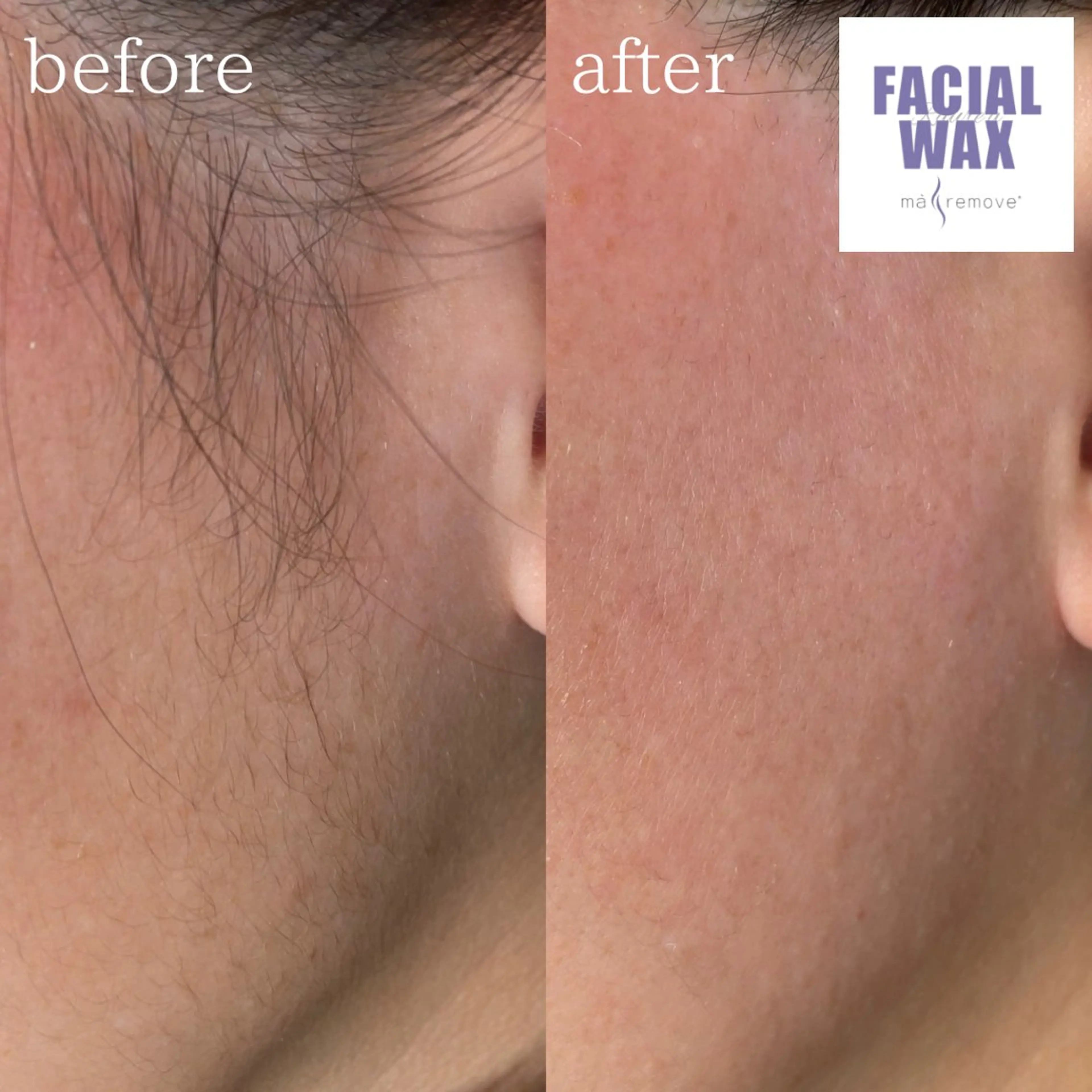 脱毛 Raure'a Yurikoのエステ・リラクイメージ