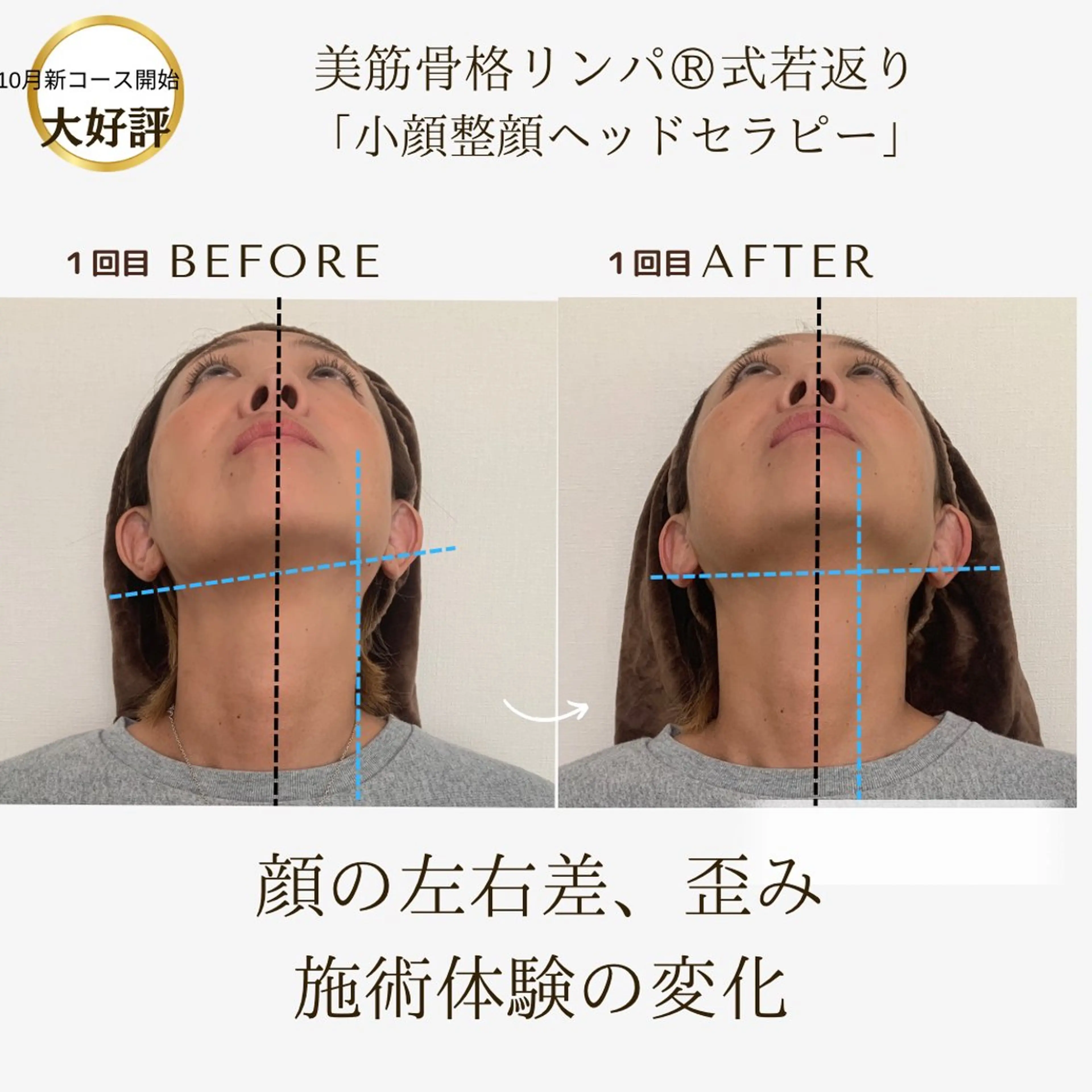 たるみ！えらはり！顔の歪み撃退！無痛の若見え小顔整顔ヘッド！新感覚！全身骨格調整×深層リンパ×小顔整顔の写真
