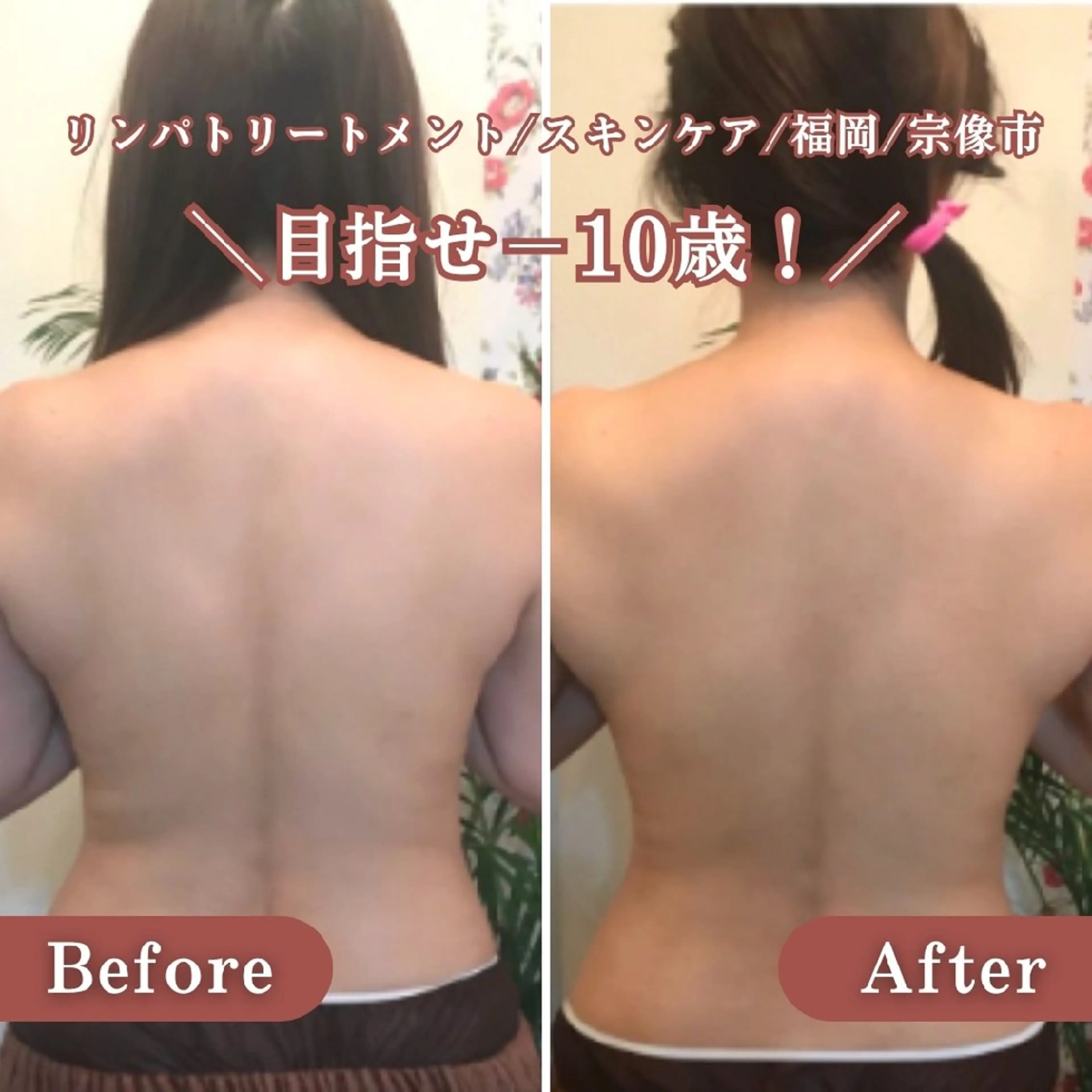 【見た目スッキリ変えるキャビテーション痩身】気になる1部位を集中撃退の写真