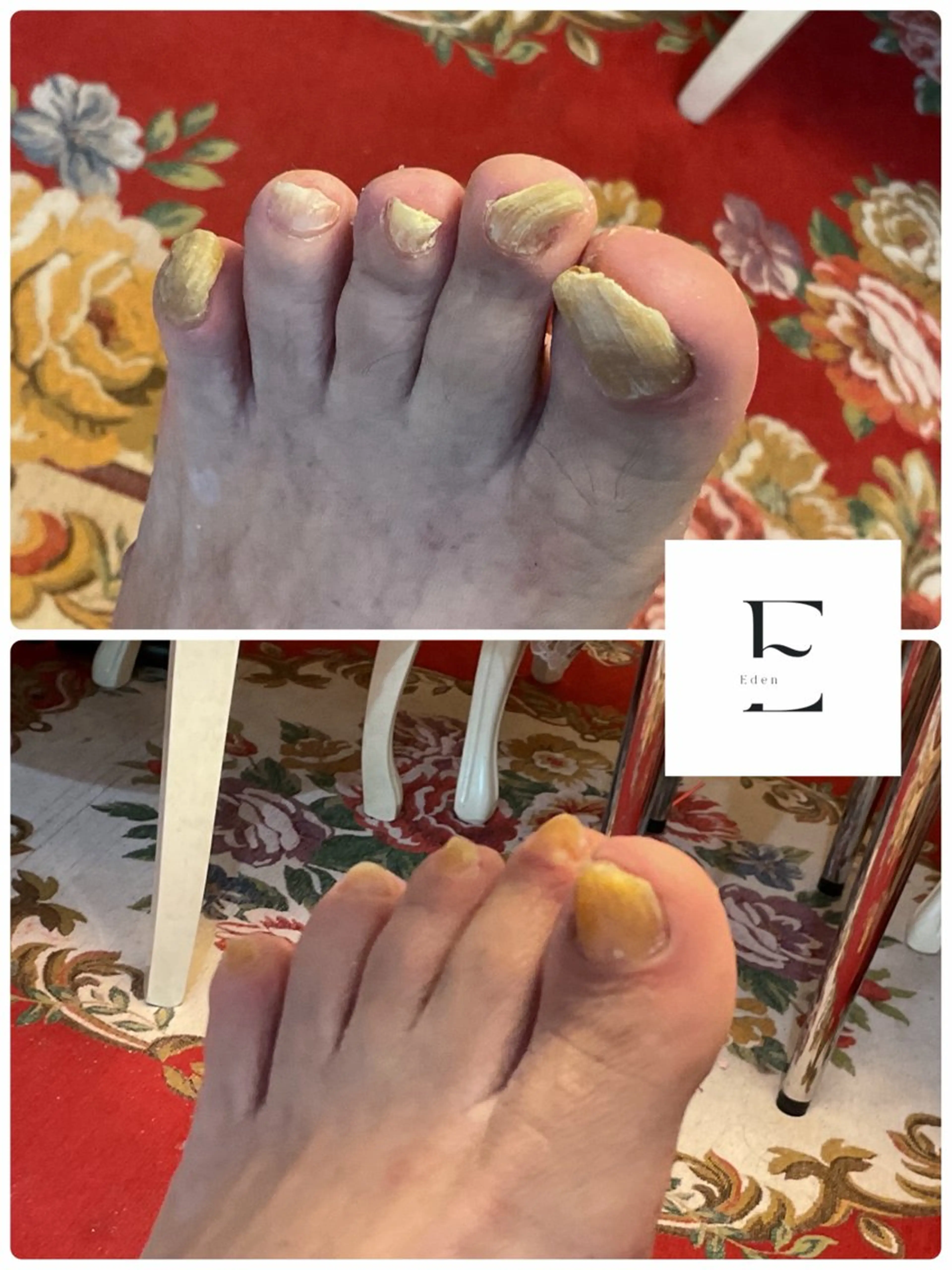 ネイル 桜ネイル フットネイル 近藤 麻子のヘアスタイル