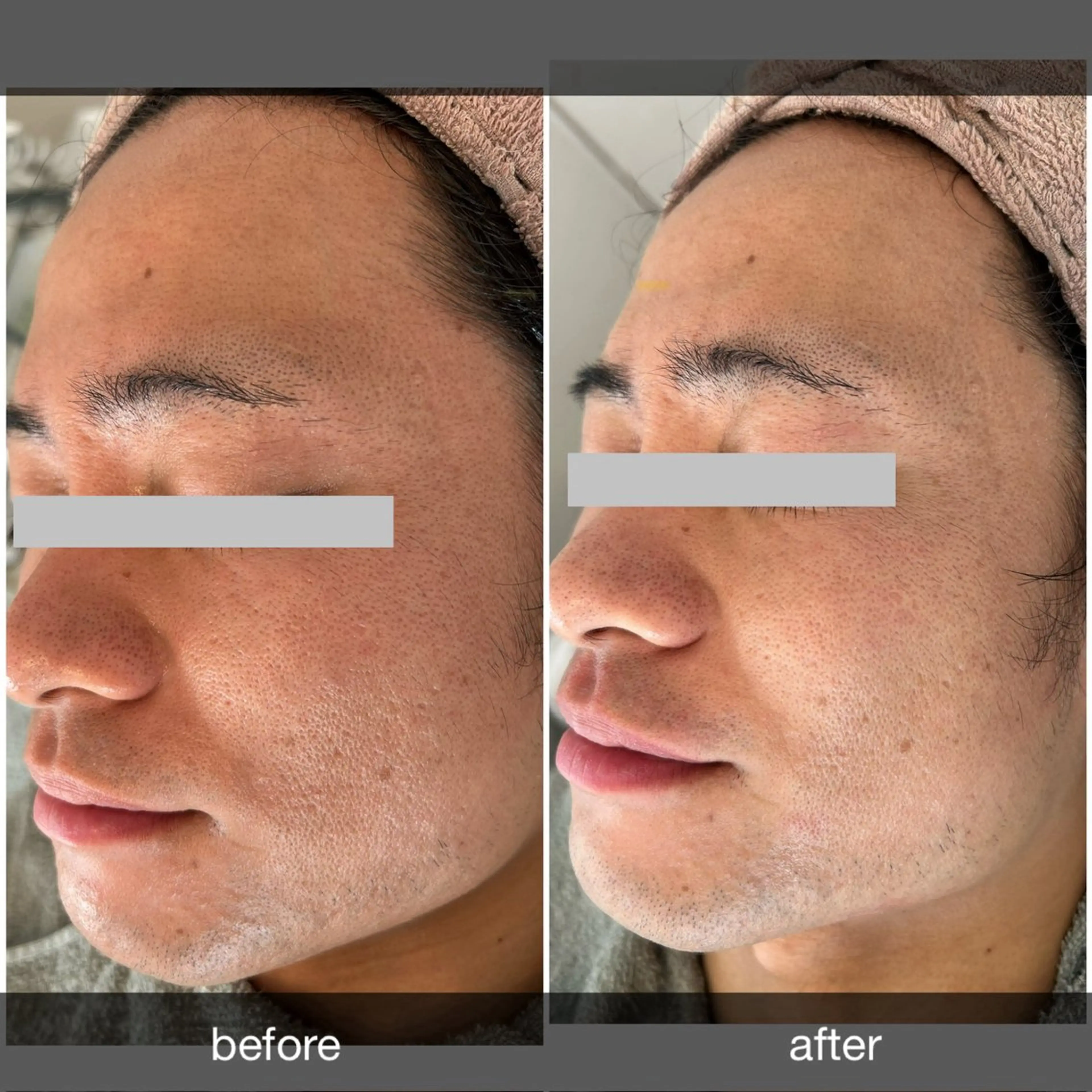 エステ プレジール所属・ビューティサロン プレジールOTAKEのエステ・リラクイメージ