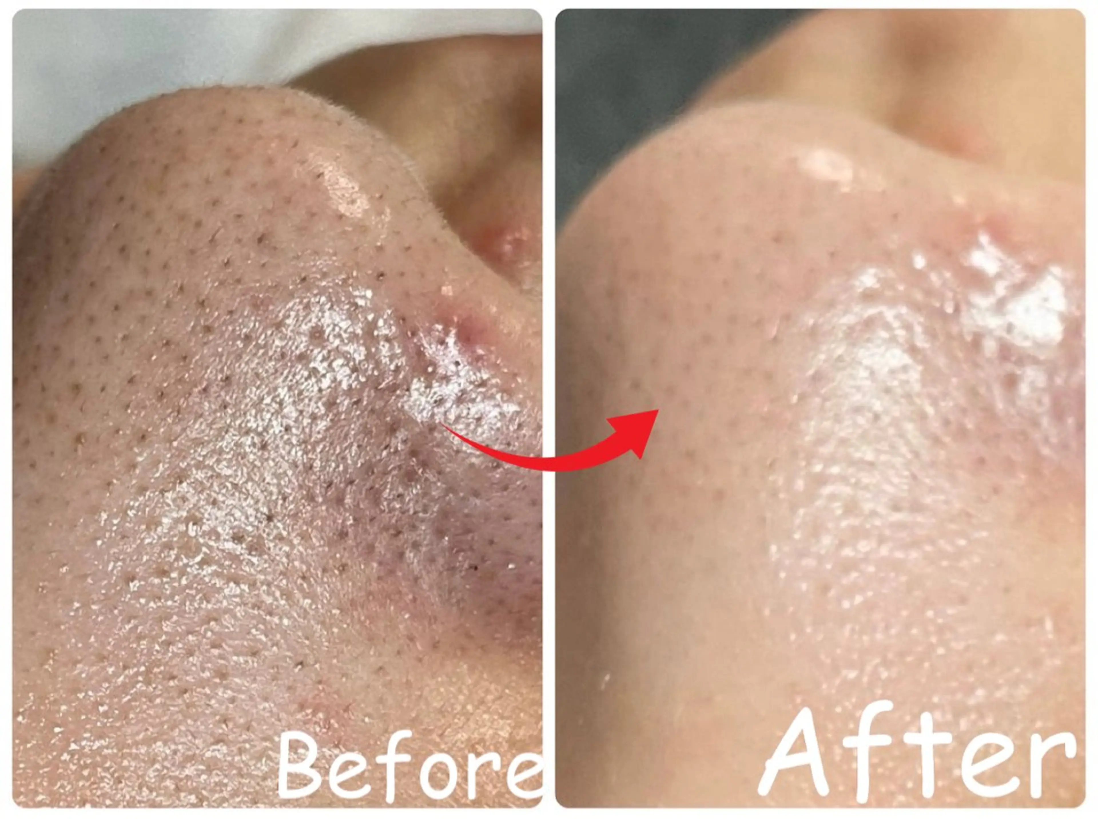 エステ リラク ele"ハーブ ピーリング 専門店のエステ・リラクイメージ