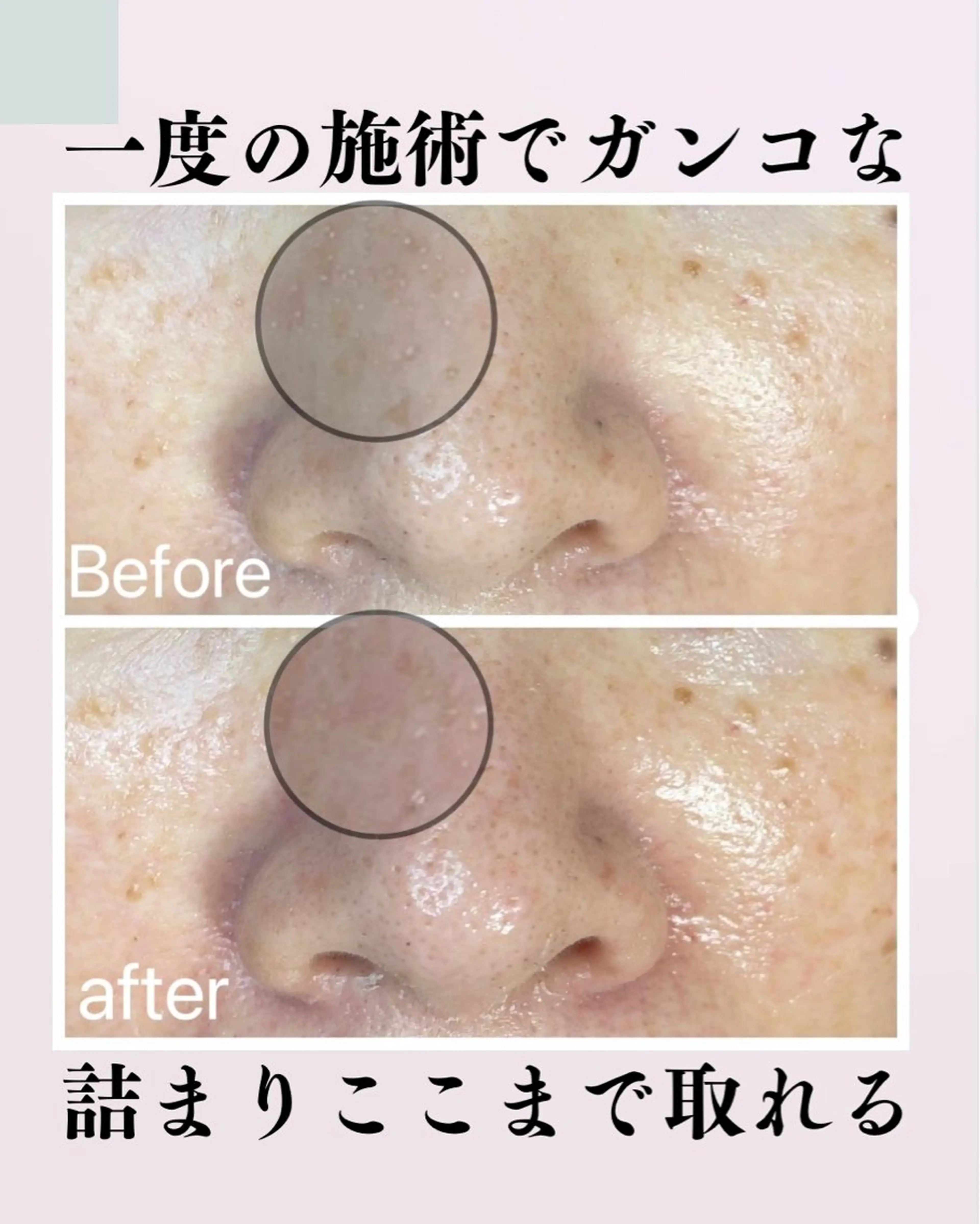 肌質改善サロン facialmoonのエステ・リラクイメージ