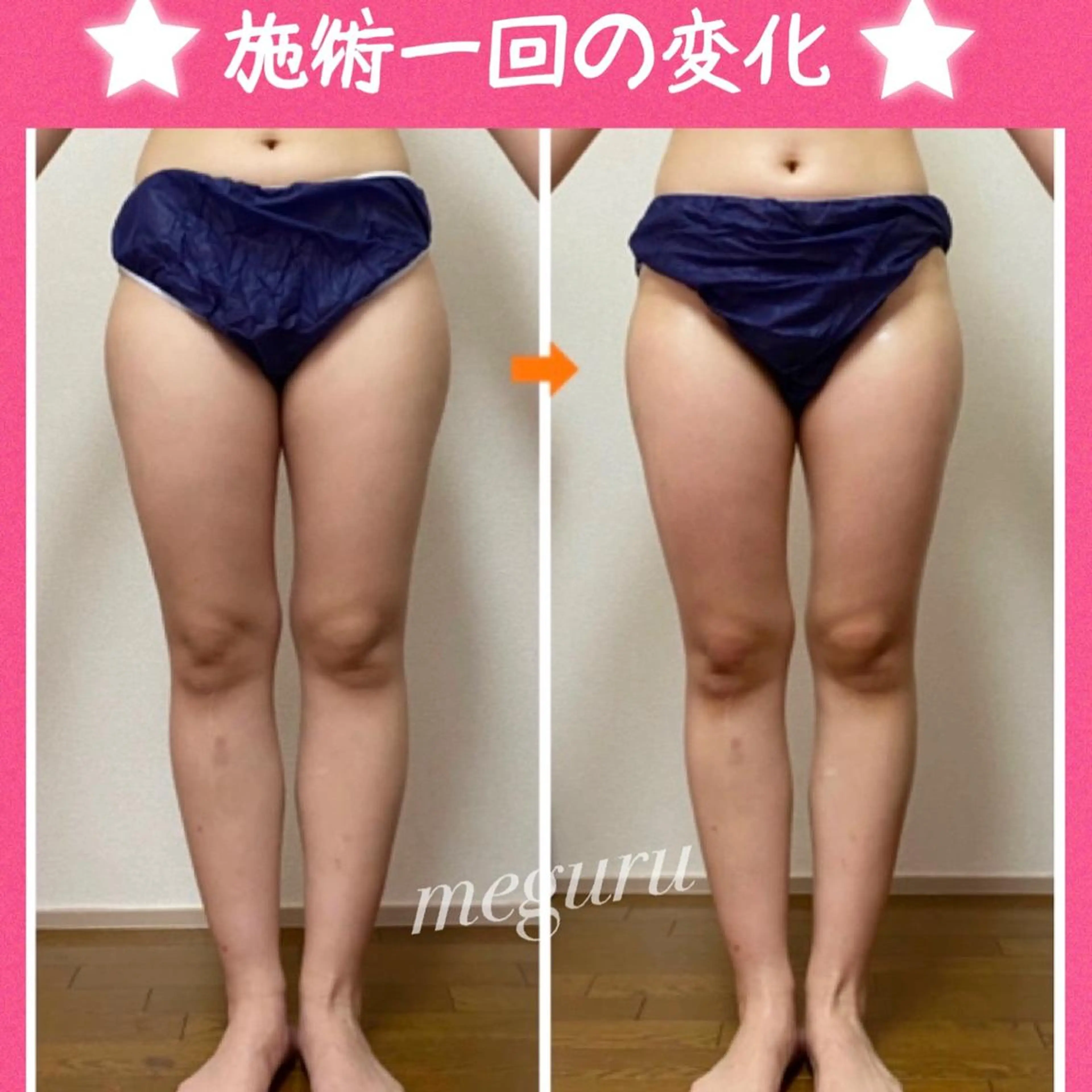 ショート カラー パーマ ヘアアレンジ メンズ ネイル マツエク・マツパ エステ リラク ‍痩身＆ボディ 結果出し🌟丹野のエステ・リラクイメージ