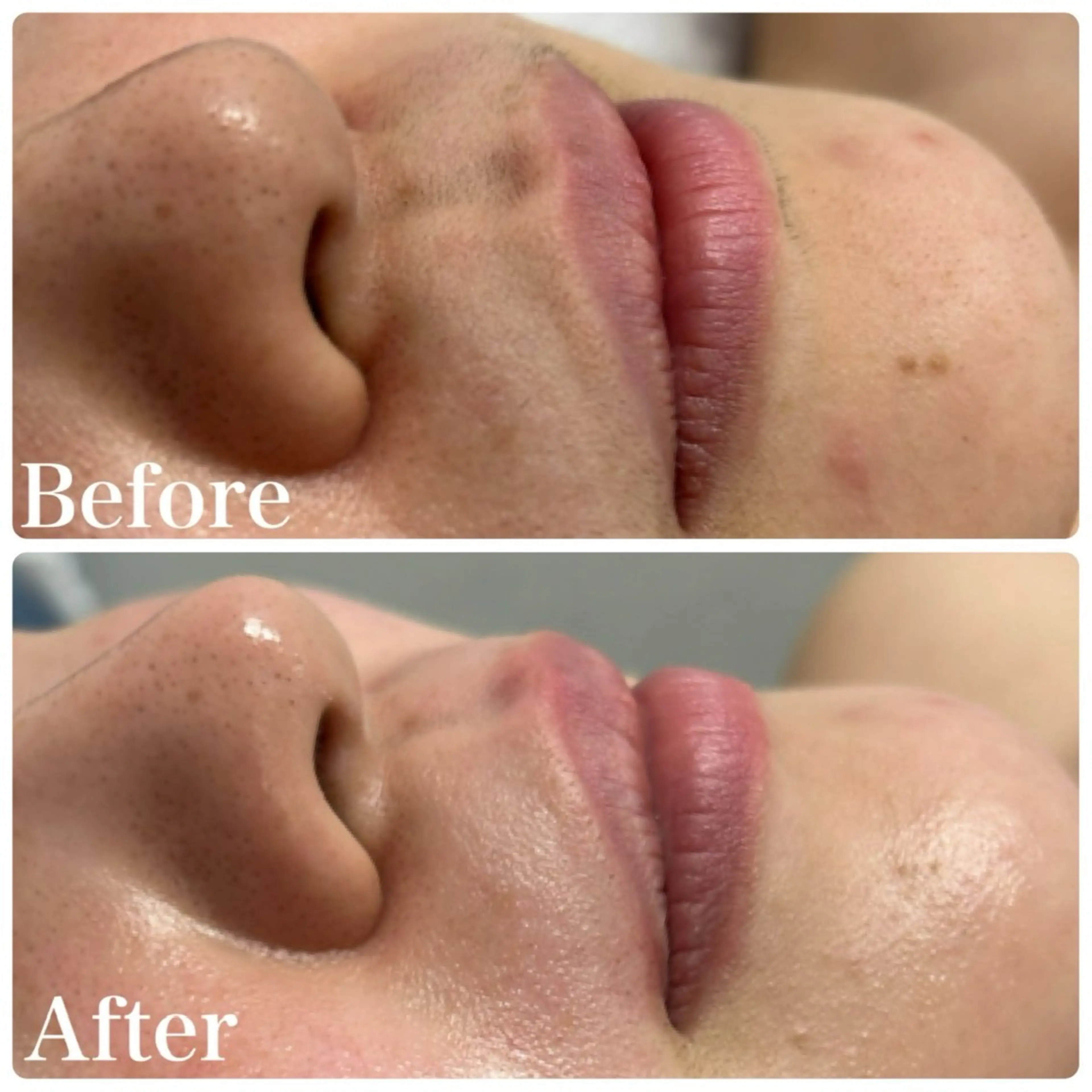 エステ LAKI eye&face studio所属・laki studioの眉毛・アイブロウイメージ