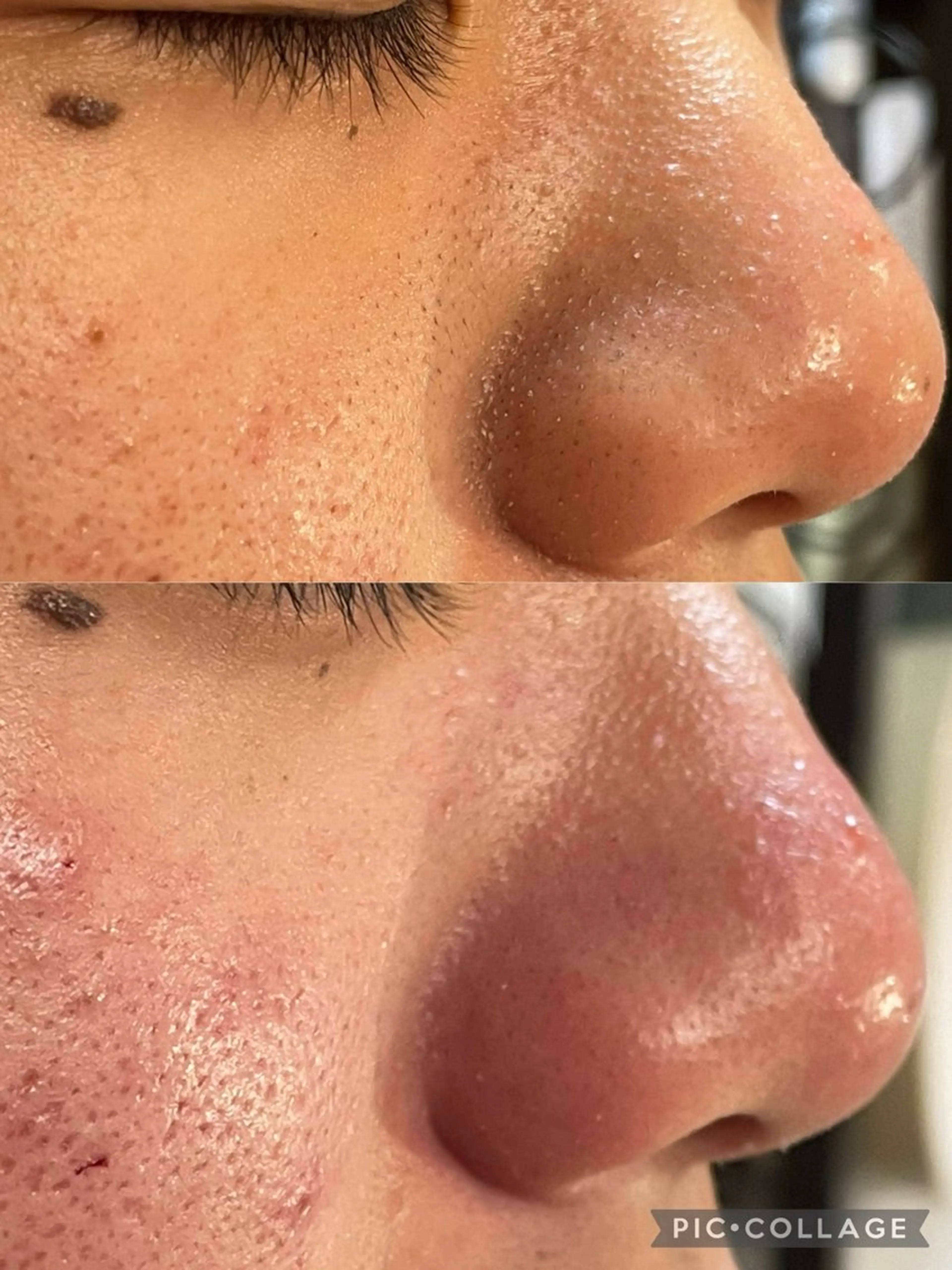 お肌のかかりつけサロンP.A.L.M.所属・【P.A.L.M.】 むき卵×毛穴レス肌のエステ・リラクイメージ