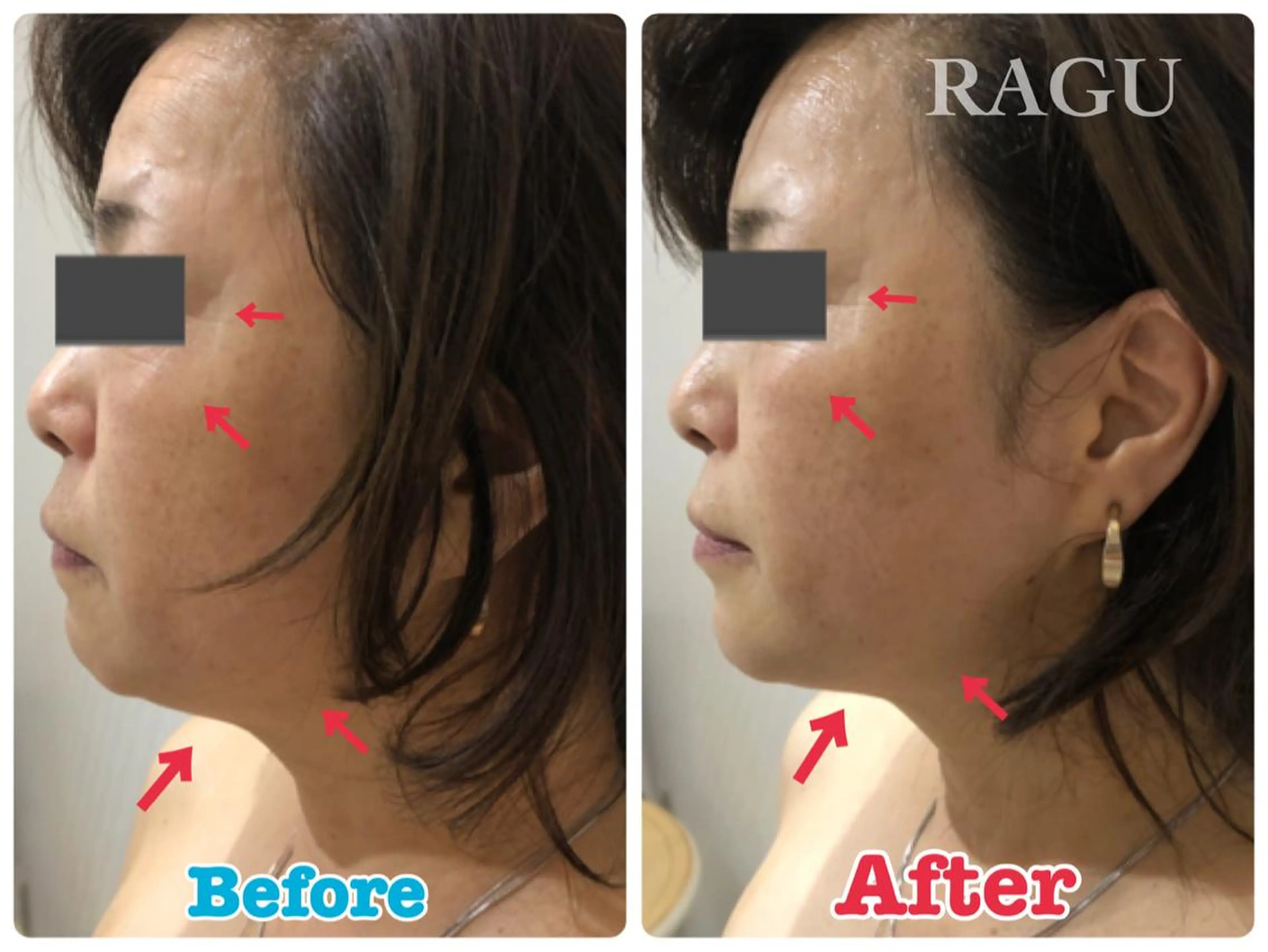 エステ RAGU BEAUTY所属・原口 彩子のエステ・リラクイメージ