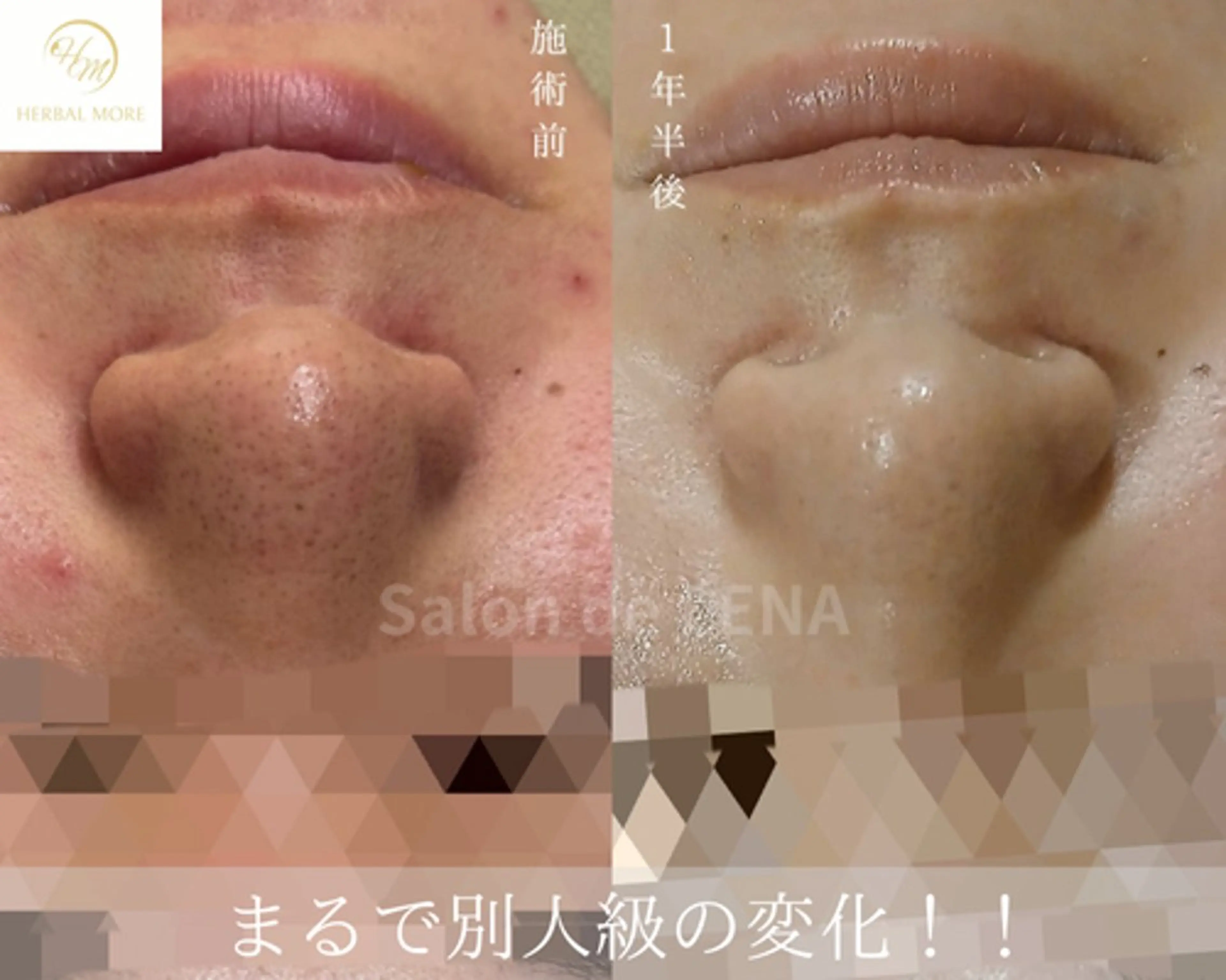 ハーブピーリング・毛穴ケア専門サロンSalon de LENA 栄店所属・ハーブピーリング専門 サロンドレナ　白藤のエステ・リラクイメージ