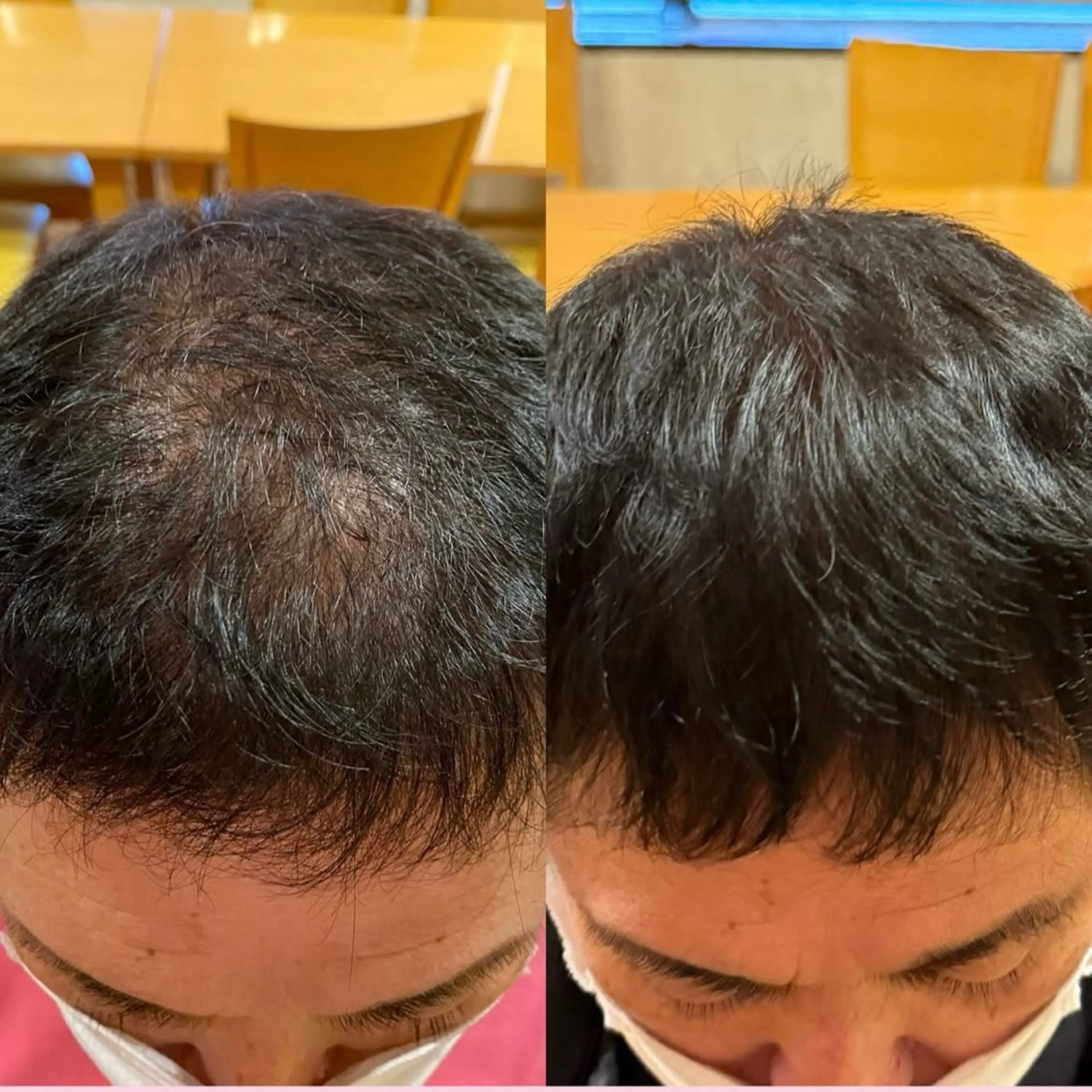 毛穴専門店MeMe.八千代店所属・\毛穴・頭皮/ のお悩みに特化💪のその他イメージ