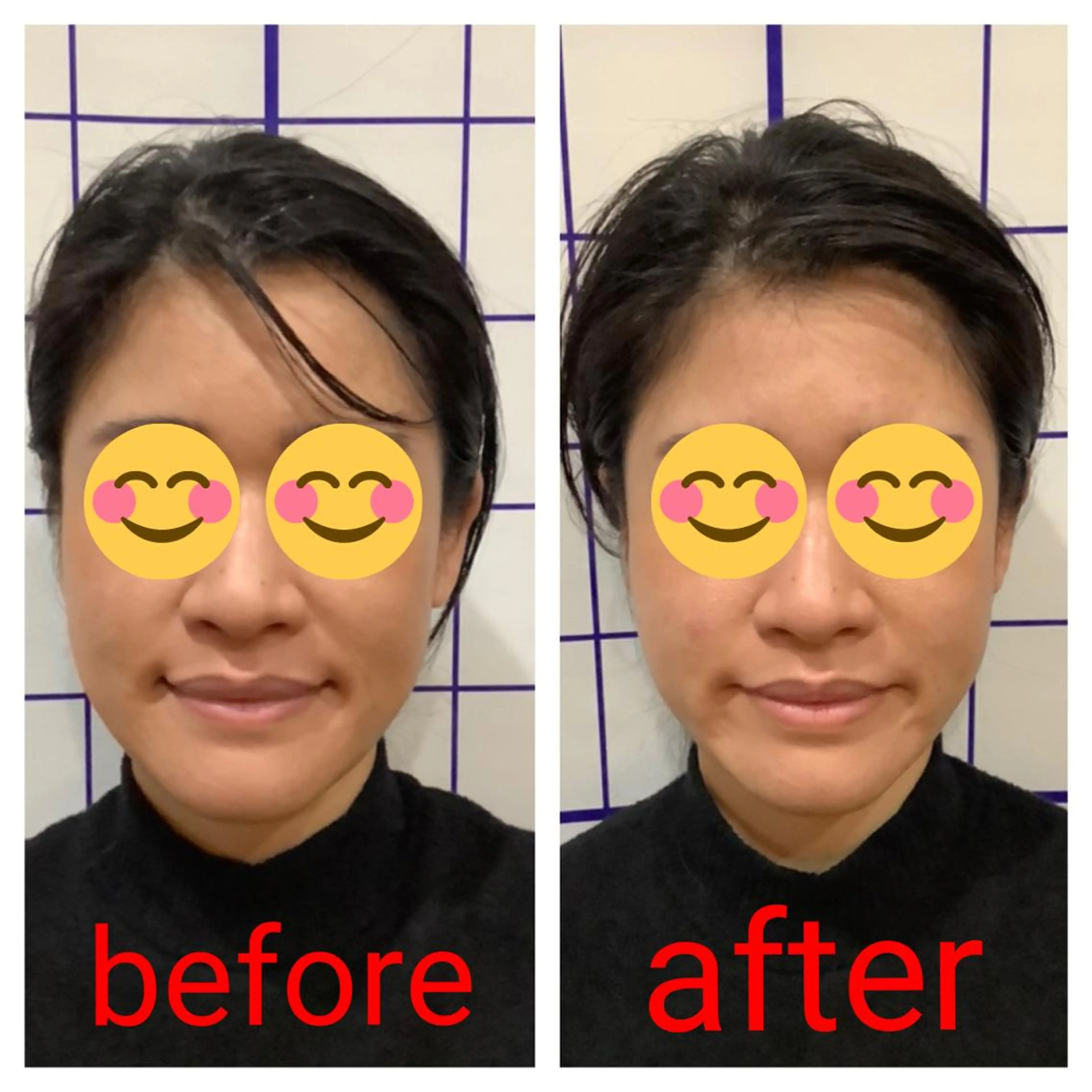 お顔のむくみたるみ 専門☆美容鍼小顔矯正のエステ・リラクイメージ