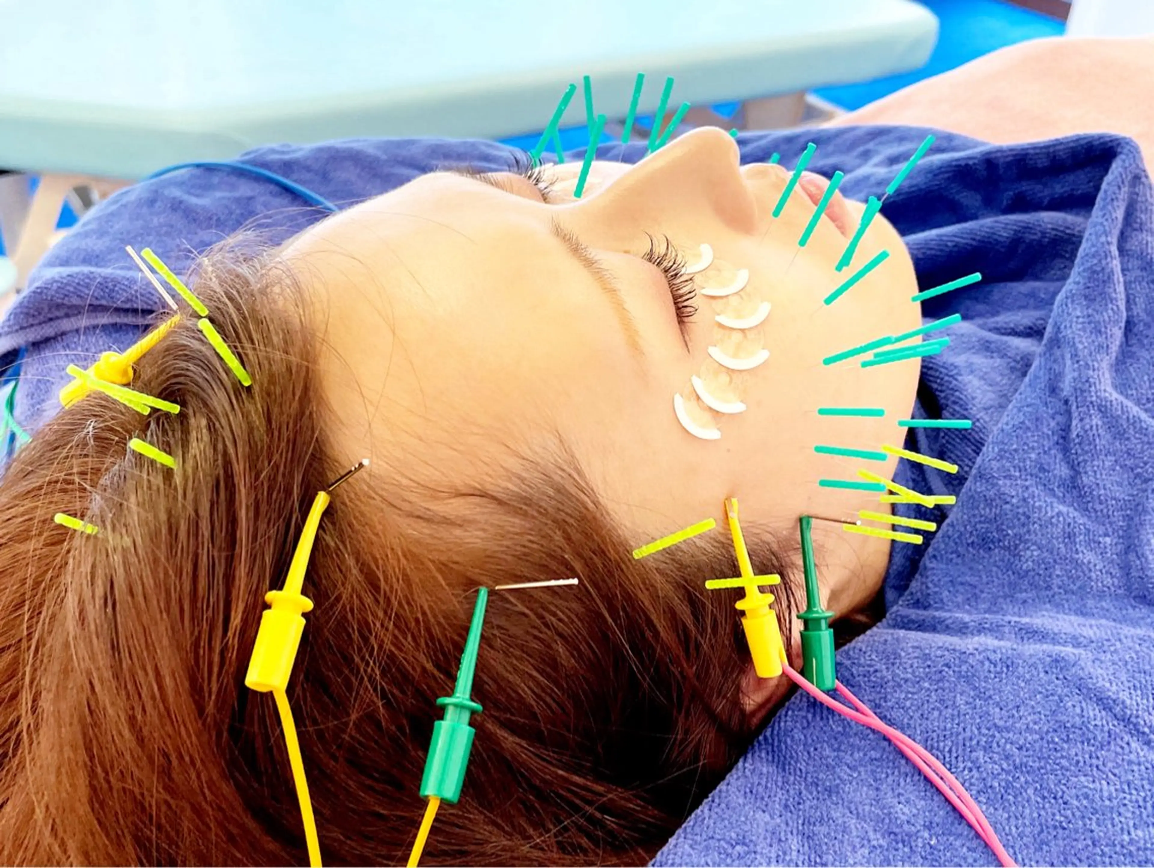小顔美容鍼専門サロン 渋谷YZのエステ・リラクイメージ