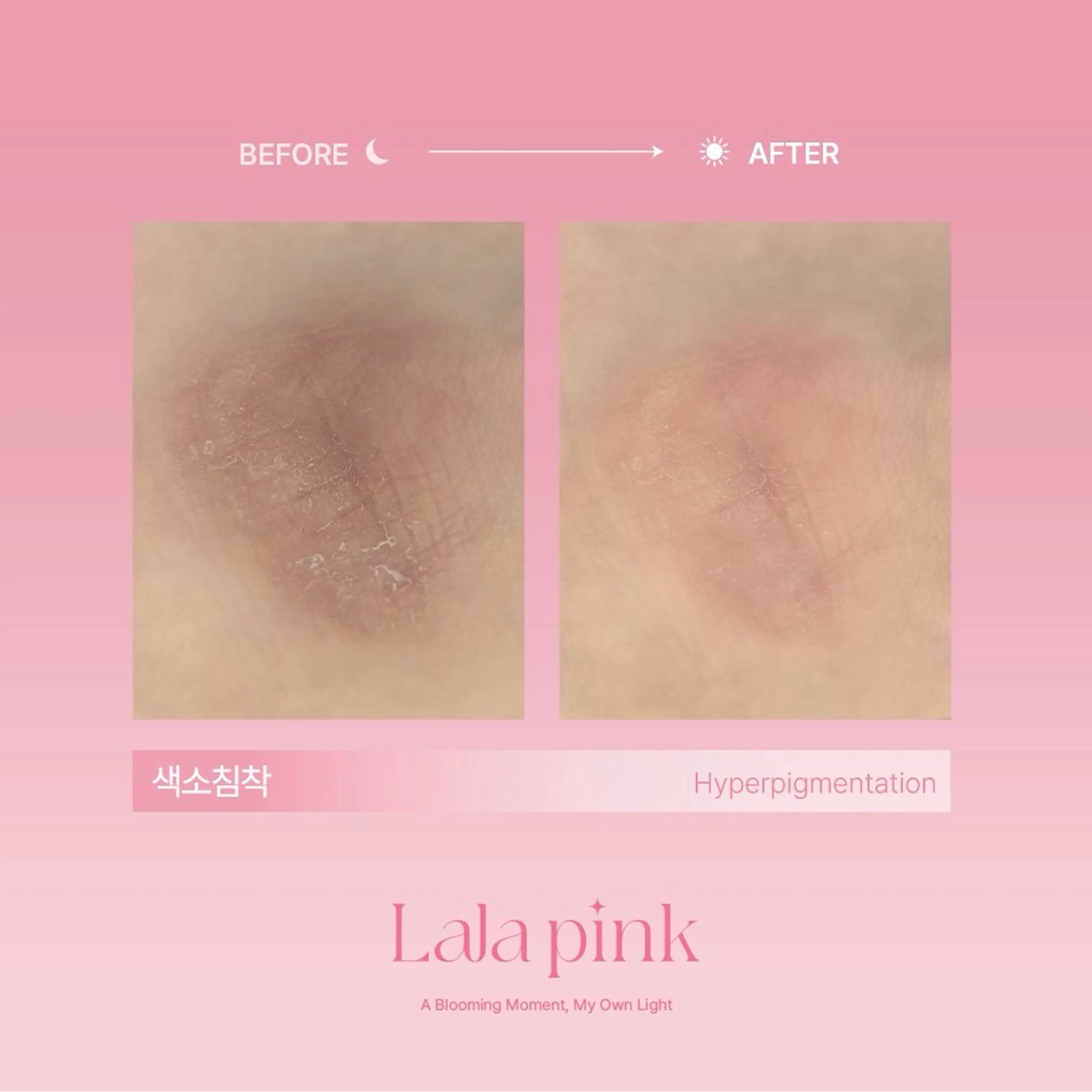 撮影モデル KIRAN 山﨑のエステ・リラクイメージ