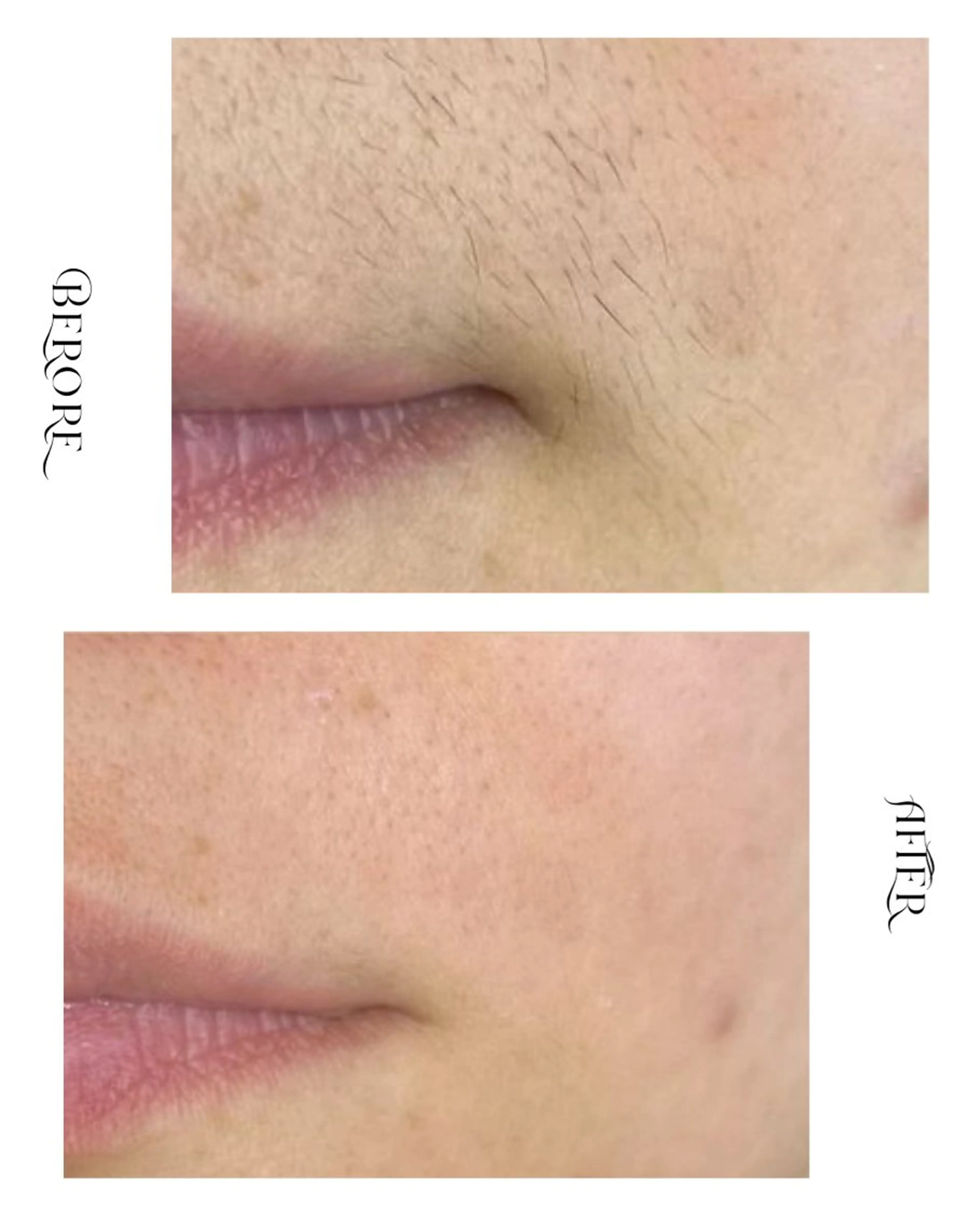 脱毛・肌質改善サロン Linoのエステ・リラクイメージ