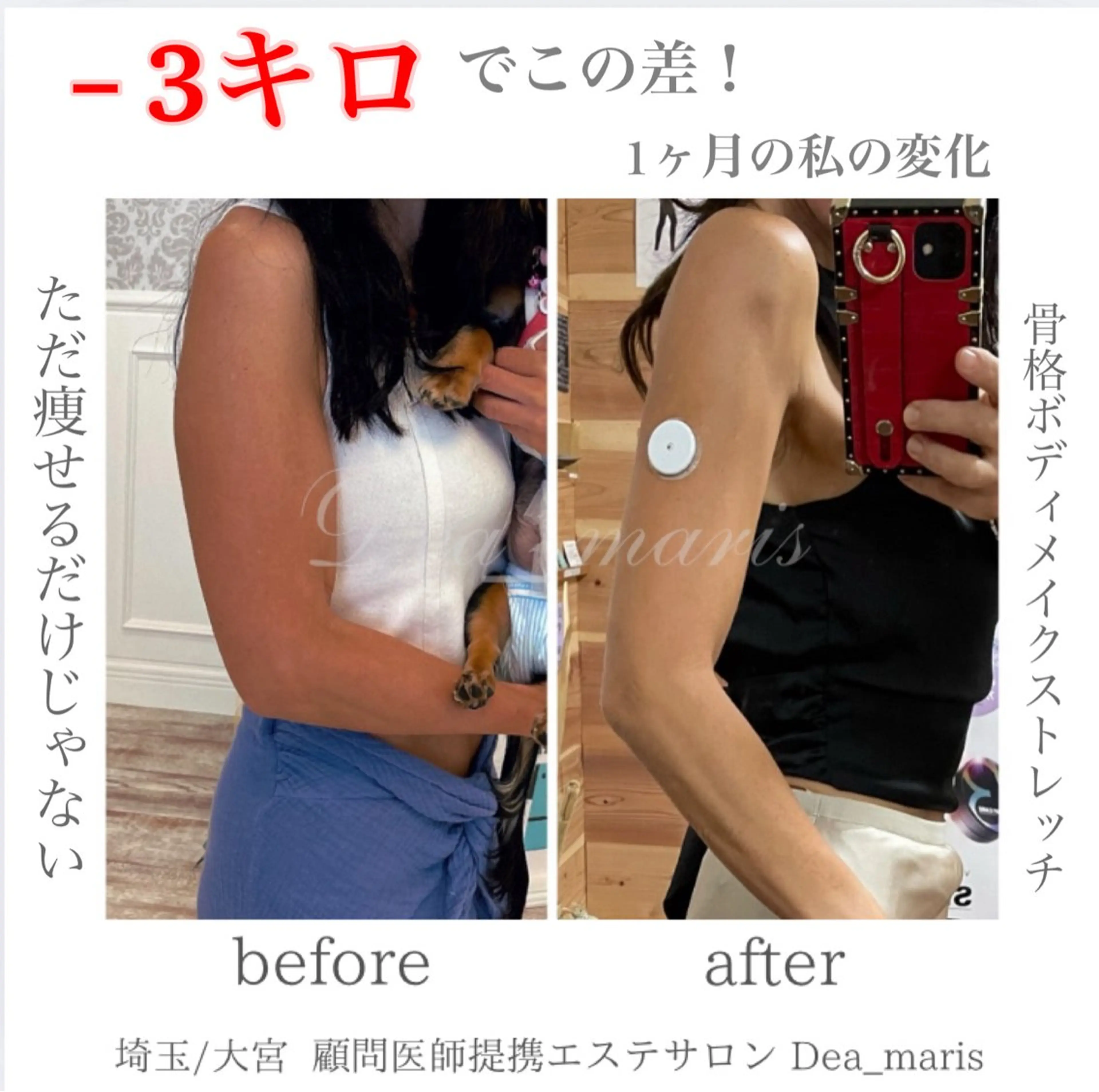 private salon Dea_maris シュガーリング&パーソナルボディケア所属・シミ改善・韓国肌管理 ボディメイク痩身のその他イメージ