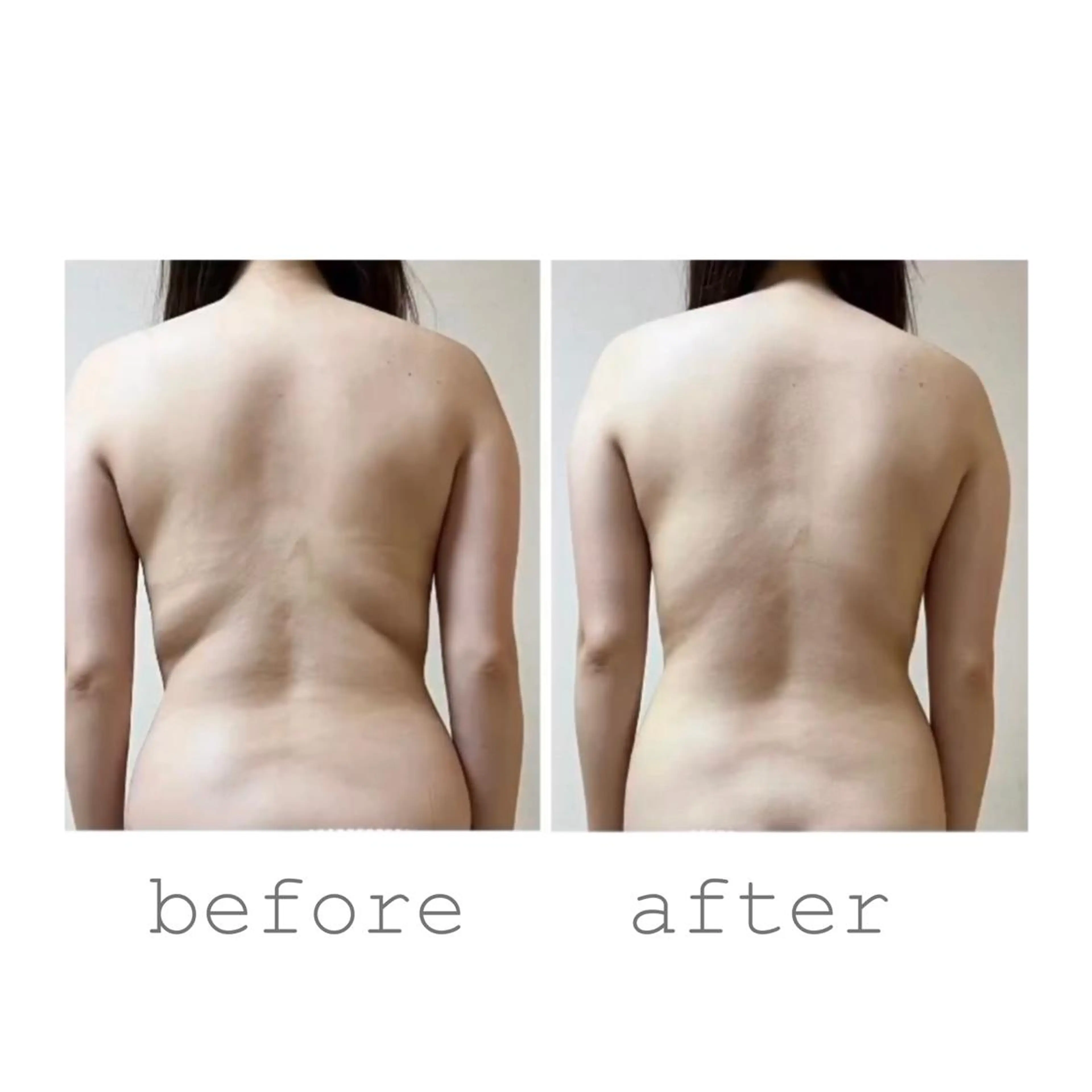 【モニター様限定】選べる箇所セルライトケア！＋マッサージ付きで即効果実感まずはお試し30分2000円📍の写真