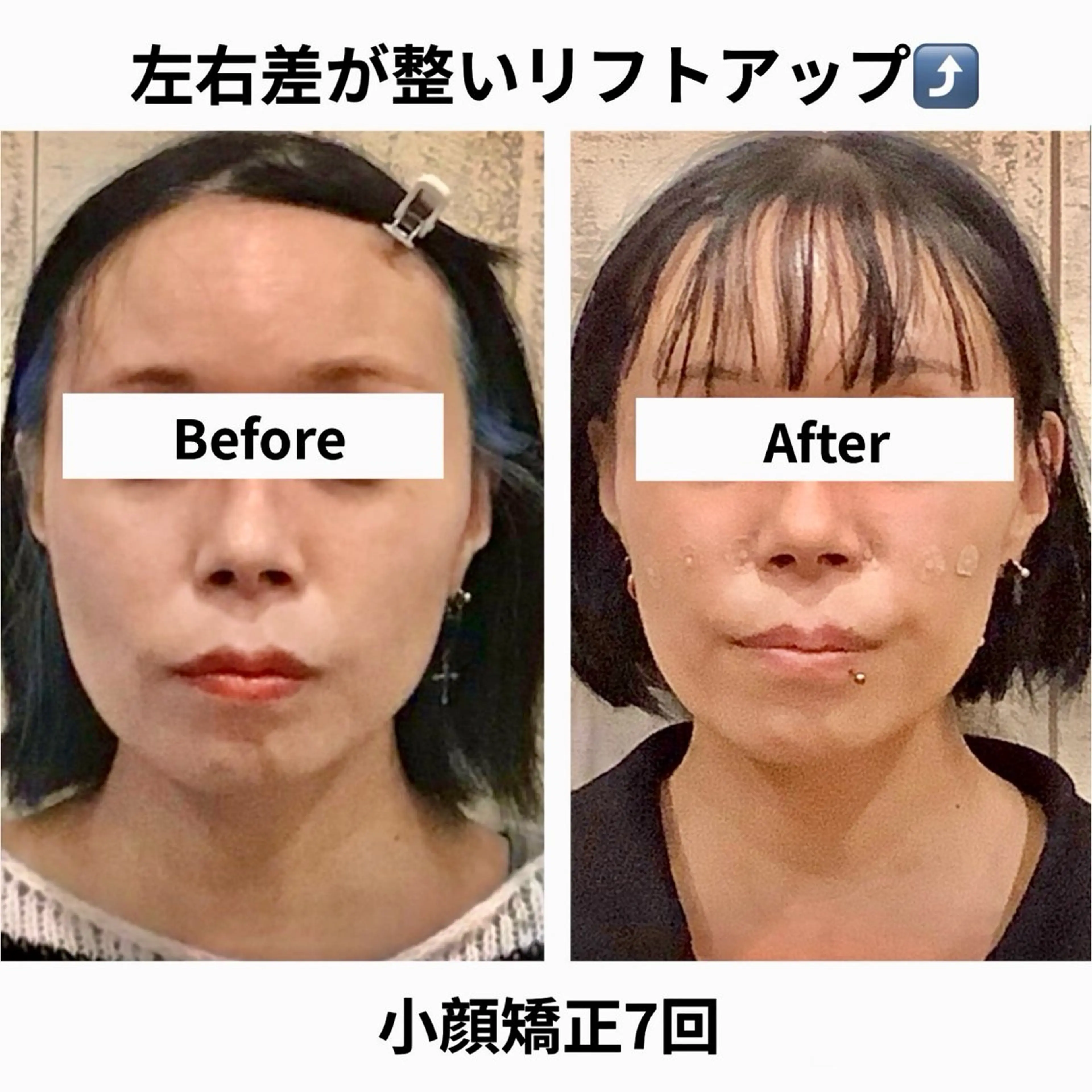 エステ リラク 小顔矯正Speed KOGAO渋谷本店のエステ・リラクイメージ