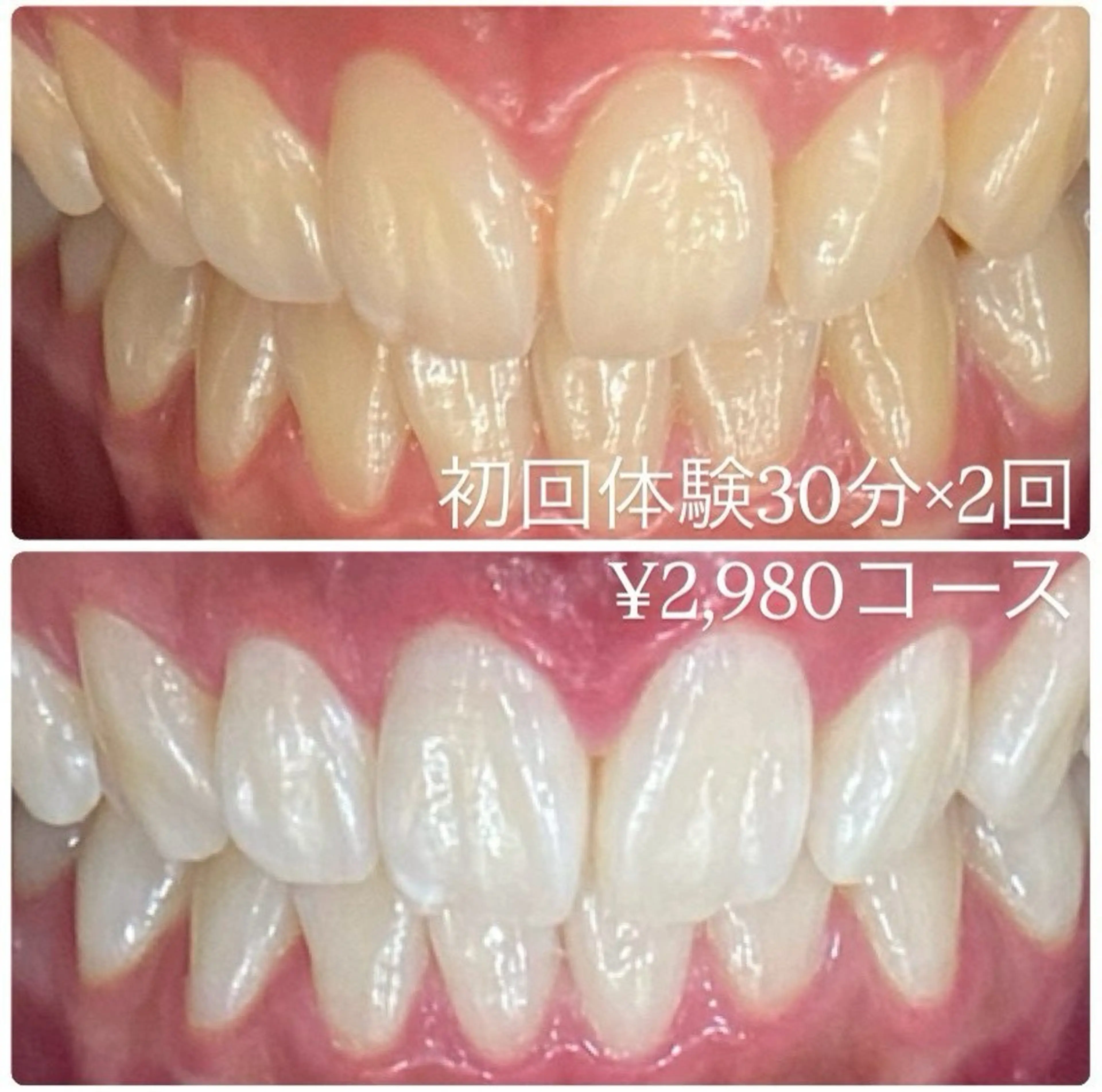 メンズ その他 ホワイトニングルーム　川崎店所属・ホワイトニング ルーム　川崎店のその他イメージ