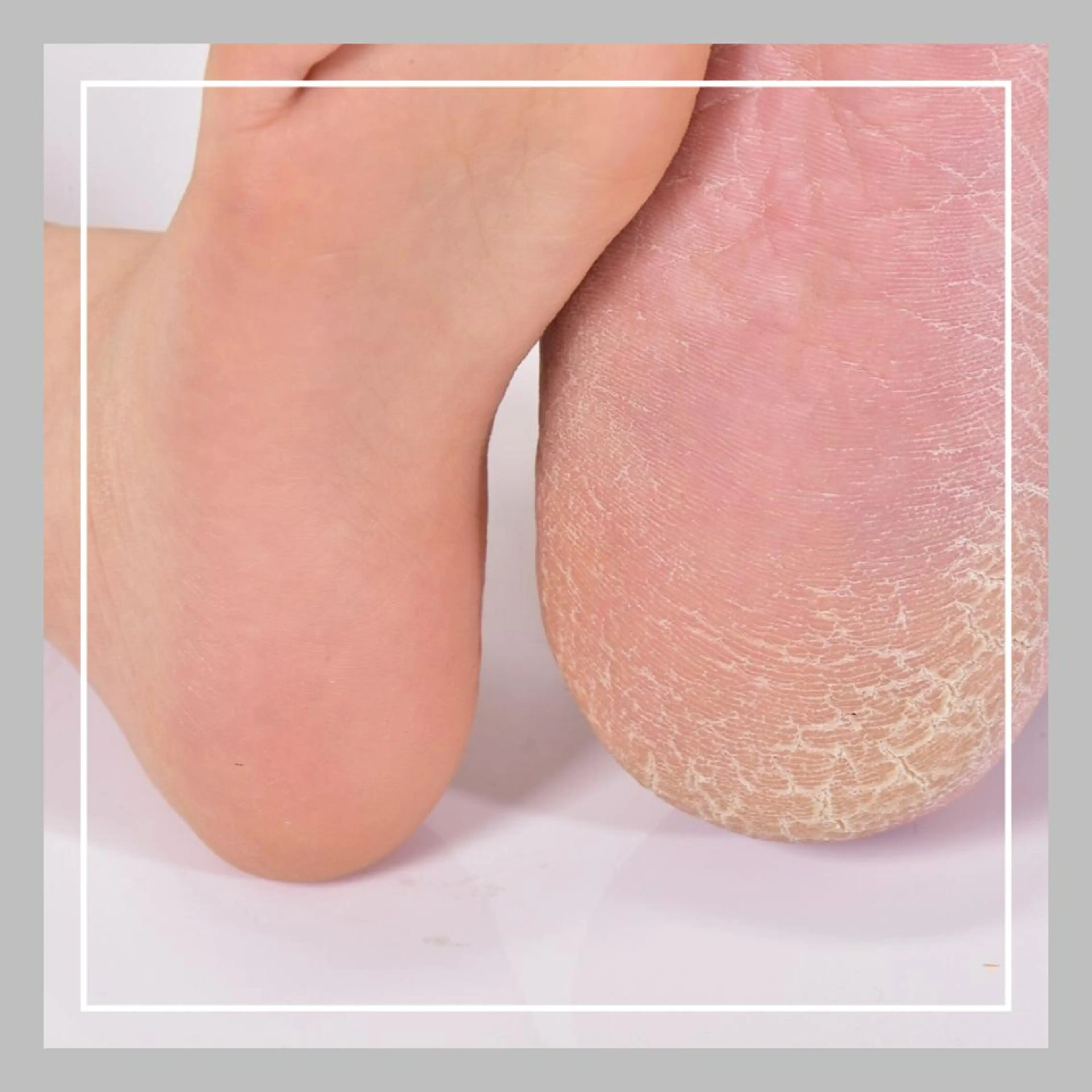 ネイル BIANCA ✴︎ ASAIのネイルデザイン