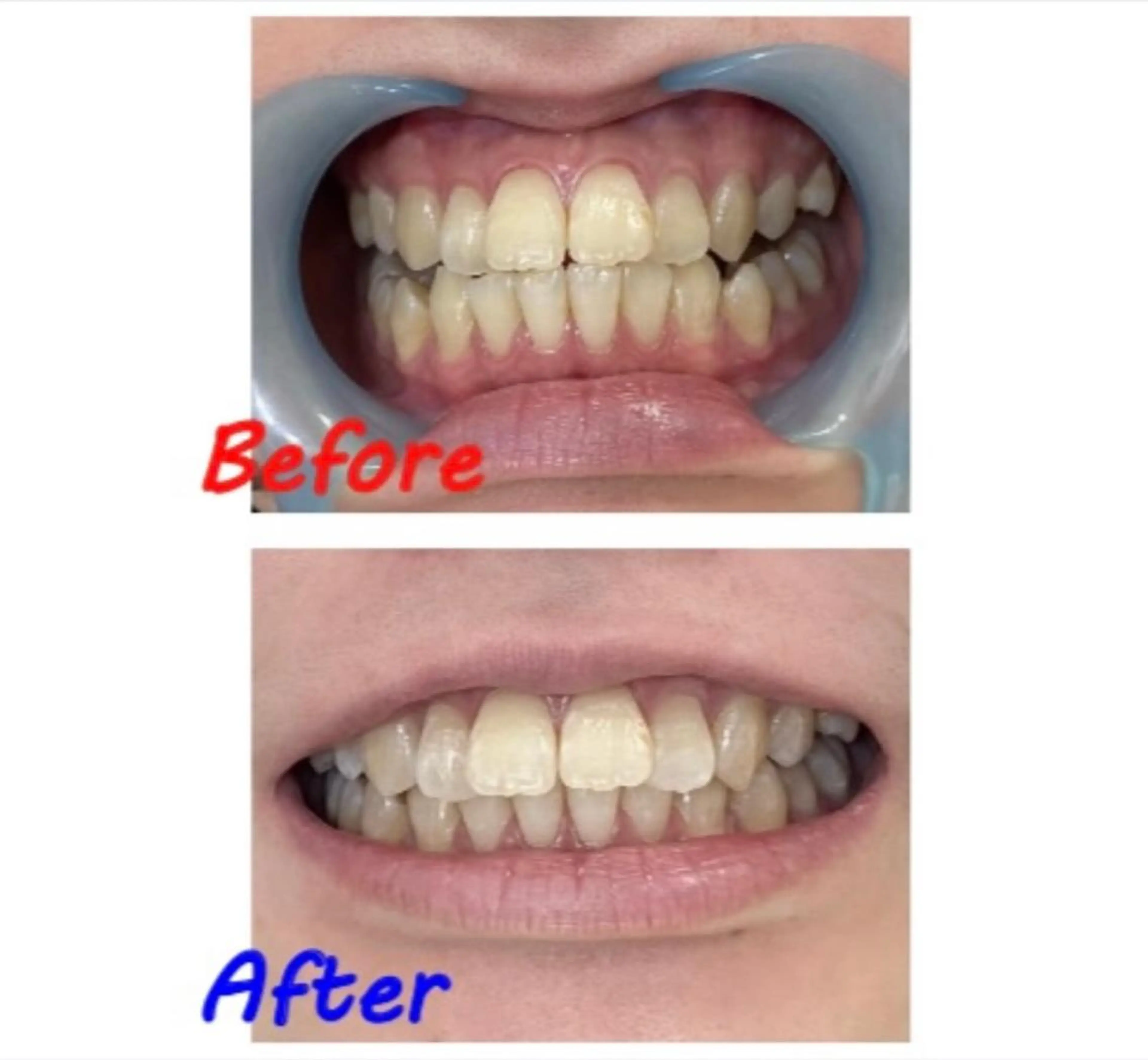 その他 セルフホワイトニングサロン　ラヴィアン所属・ホワイトニングサロン La vie enのその他イメージ