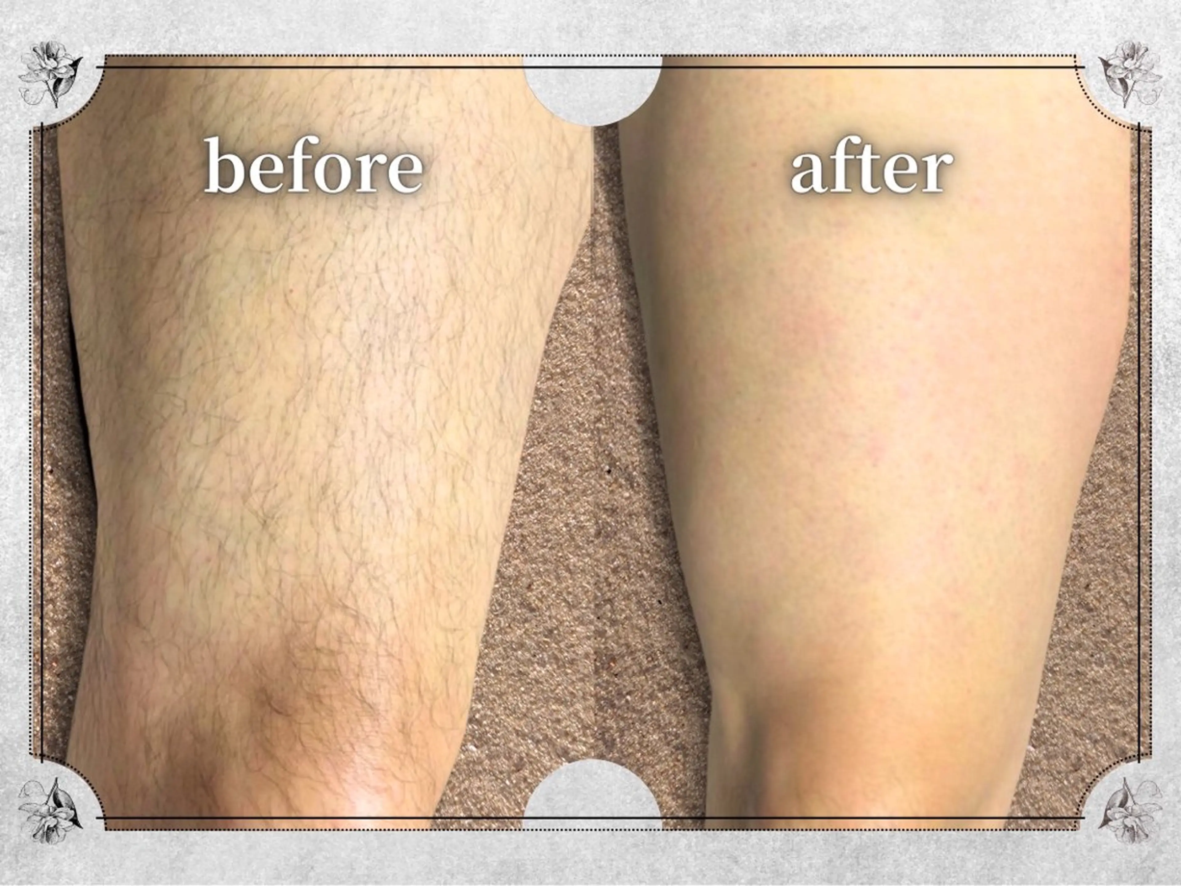 都度払い 脱毛 Lino柏/moeのエステ・リラクイメージ