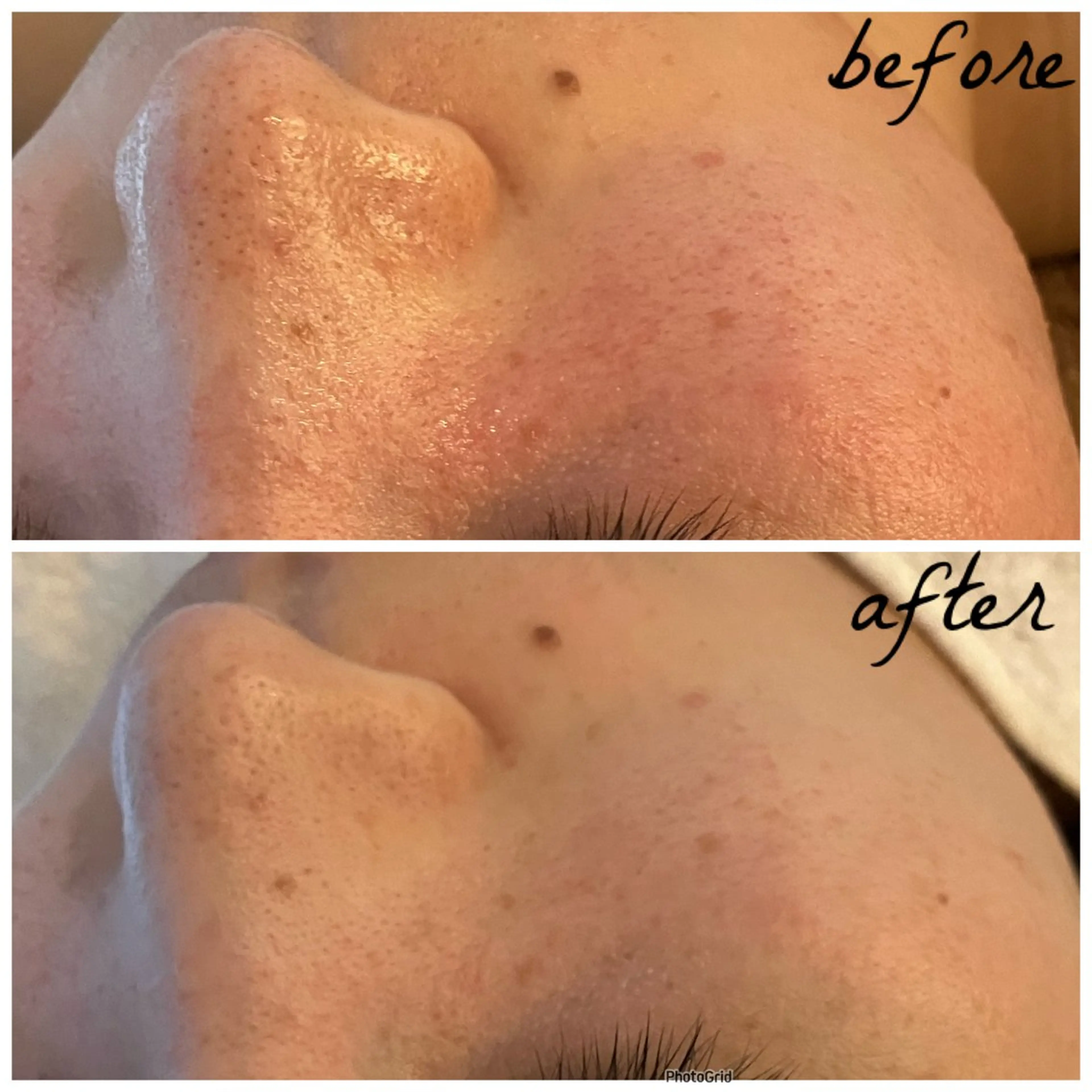 メンズ エステ メナード岐阜茜部 杉浦のエステ・リラクイメージ