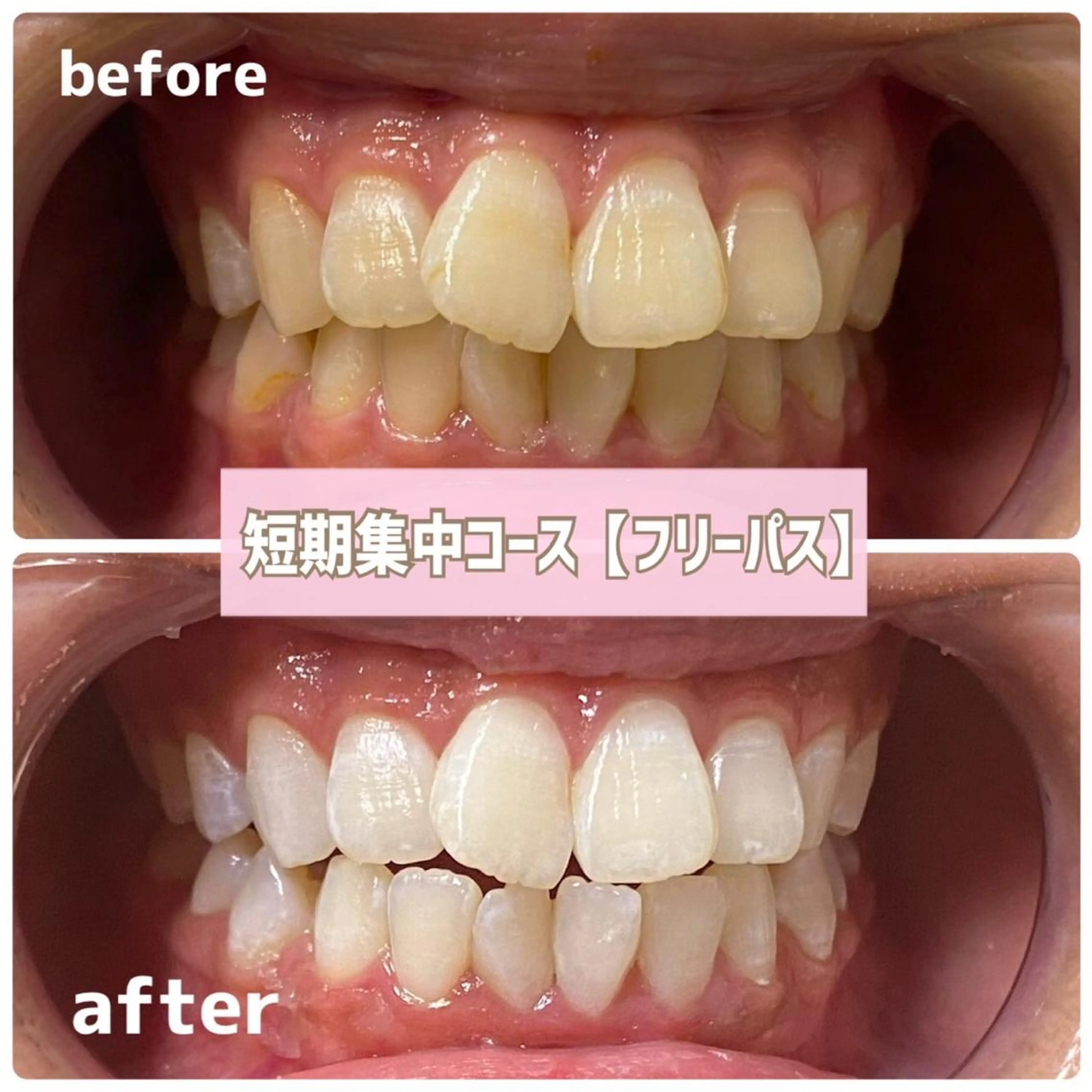 その他 ホワイトニングサロン BE WHITE金山のその他イメージ