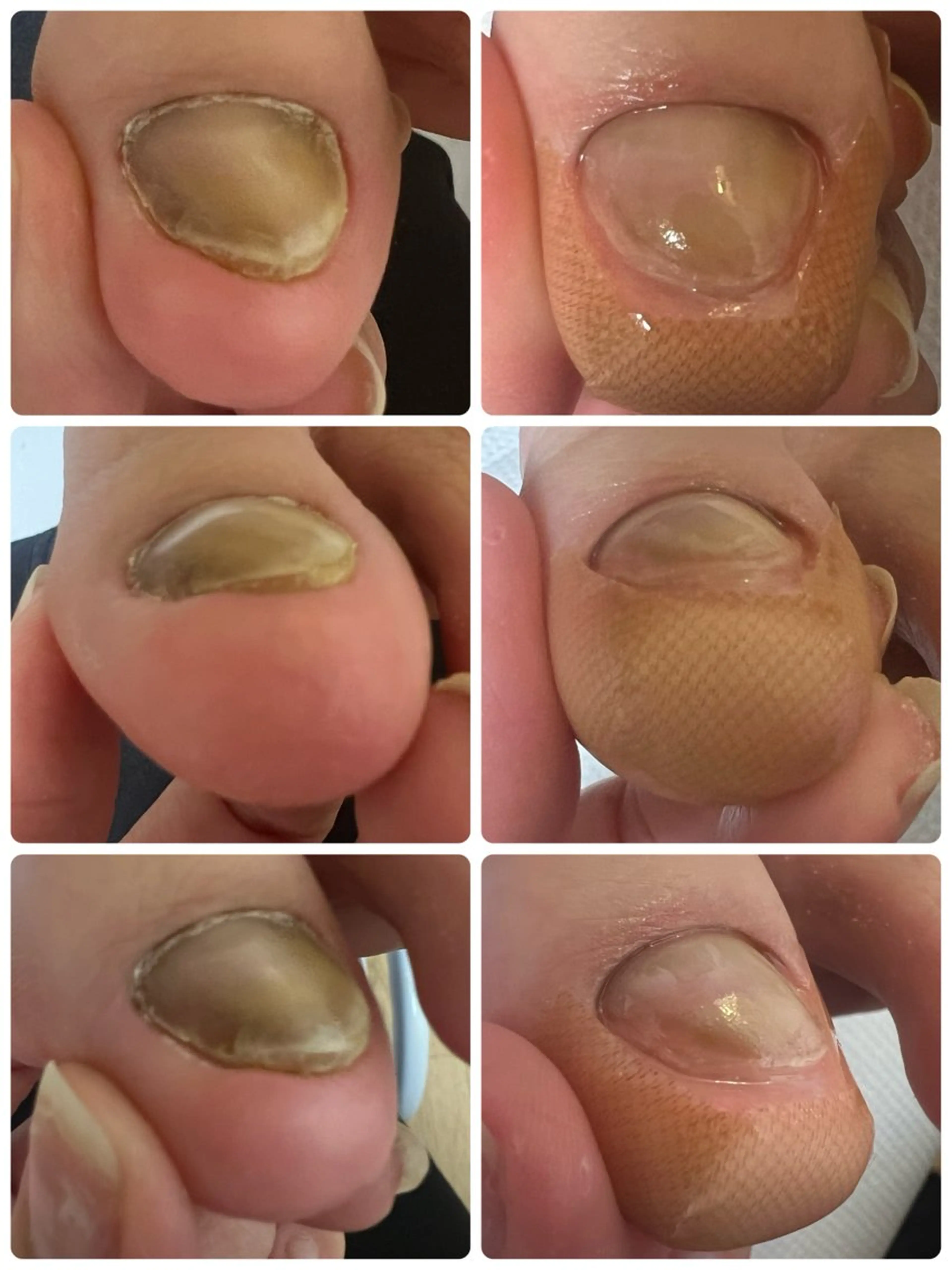 ネイル フットネイル フットネイル Belulu所属・Belulu ベルルのネイルデザイン