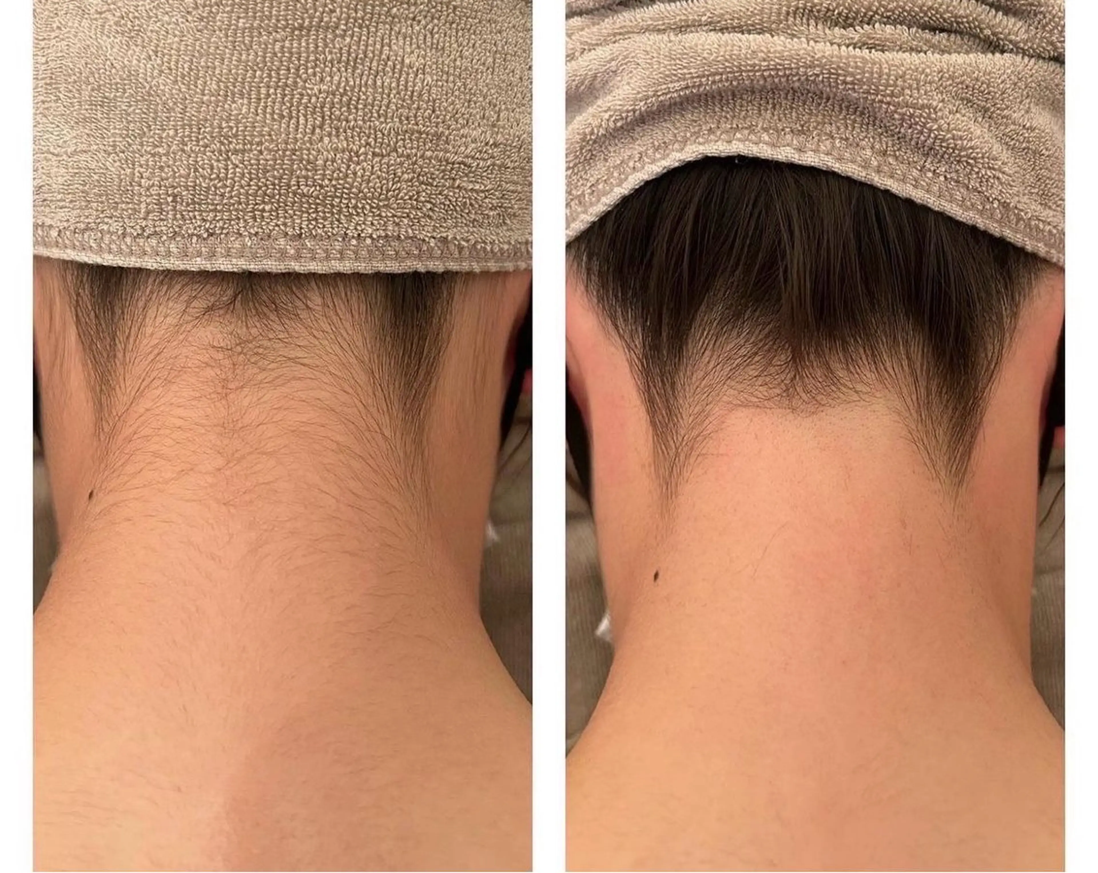 脱毛 Salon Leia所属・Salon Leiaのエステ・リラクイメージ