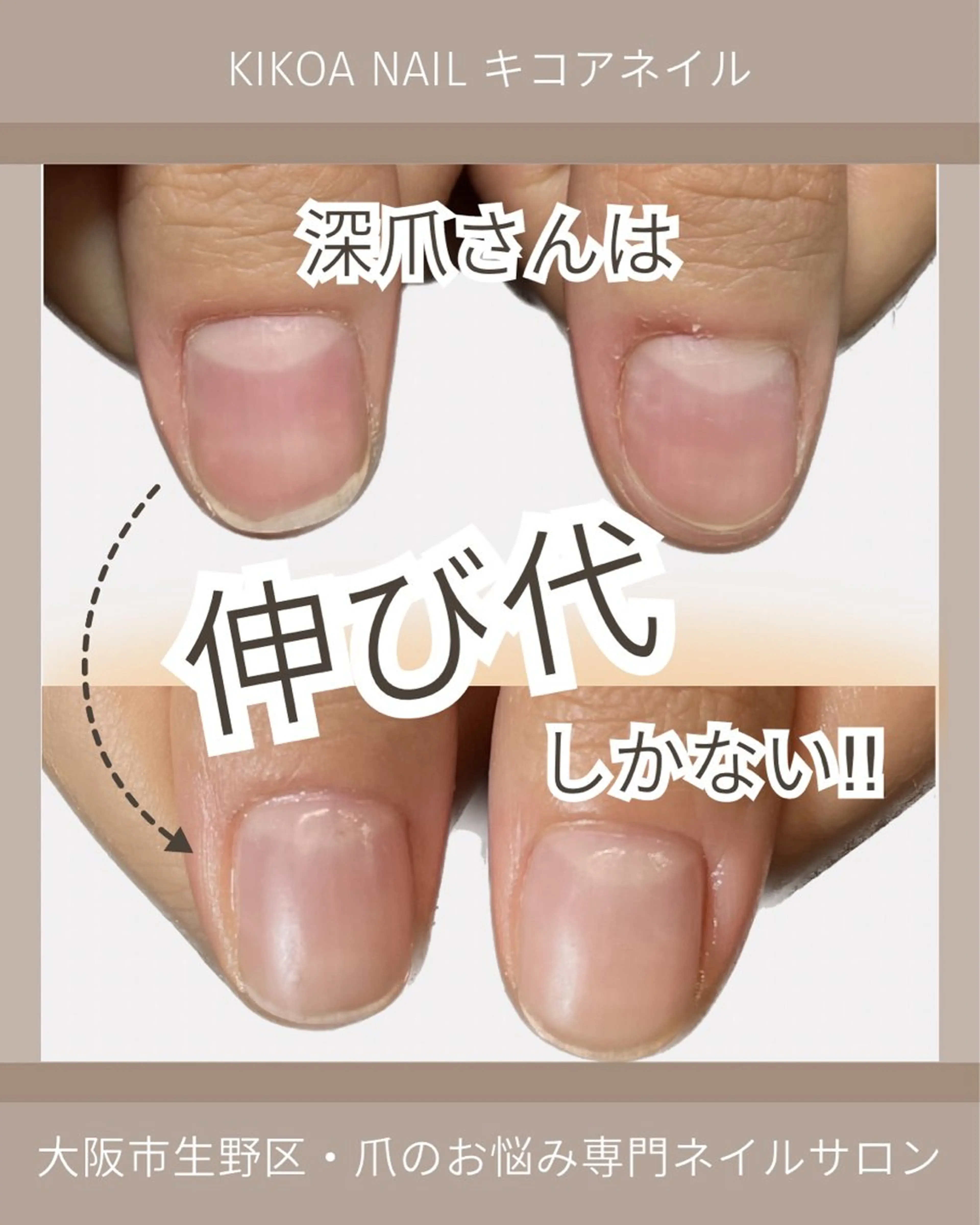 ネイル KIKOA NAIL キコアネイルのネイルデザイン