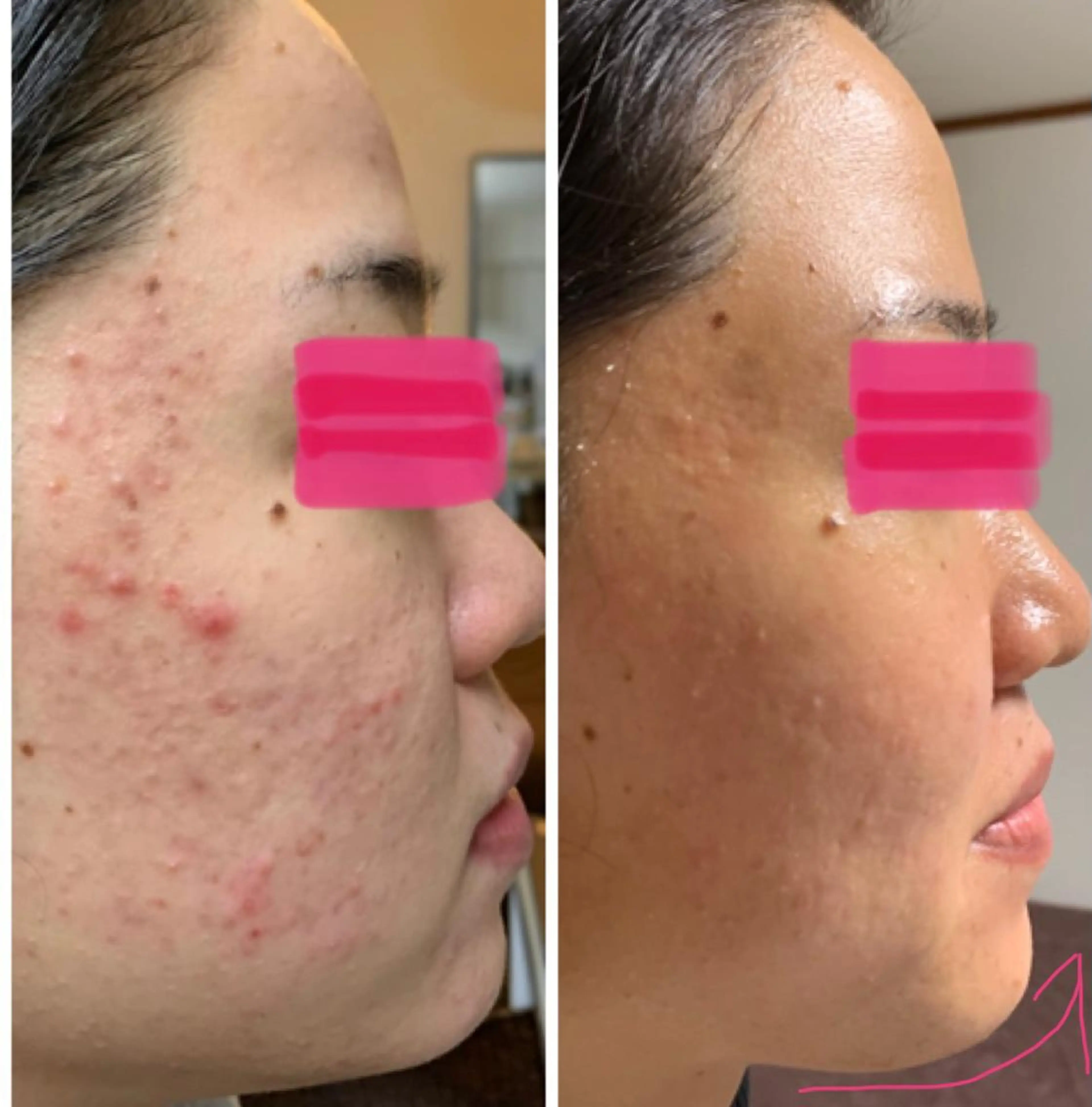 フェイシャルワックス 自然派エステファーノのその他イメージ