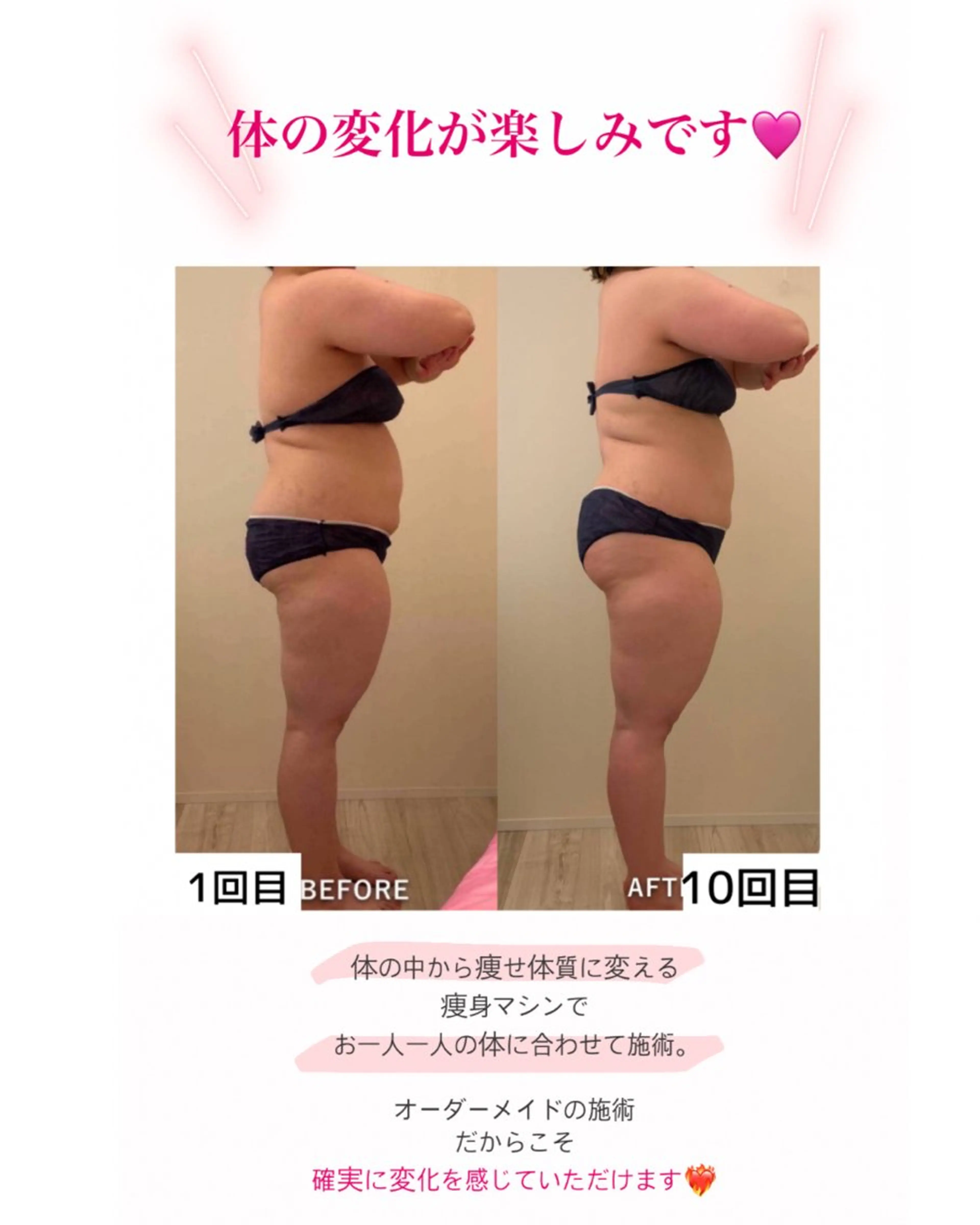 産後ダイエット−9㎏ Pourvous結衣のエステ・リラクイメージ