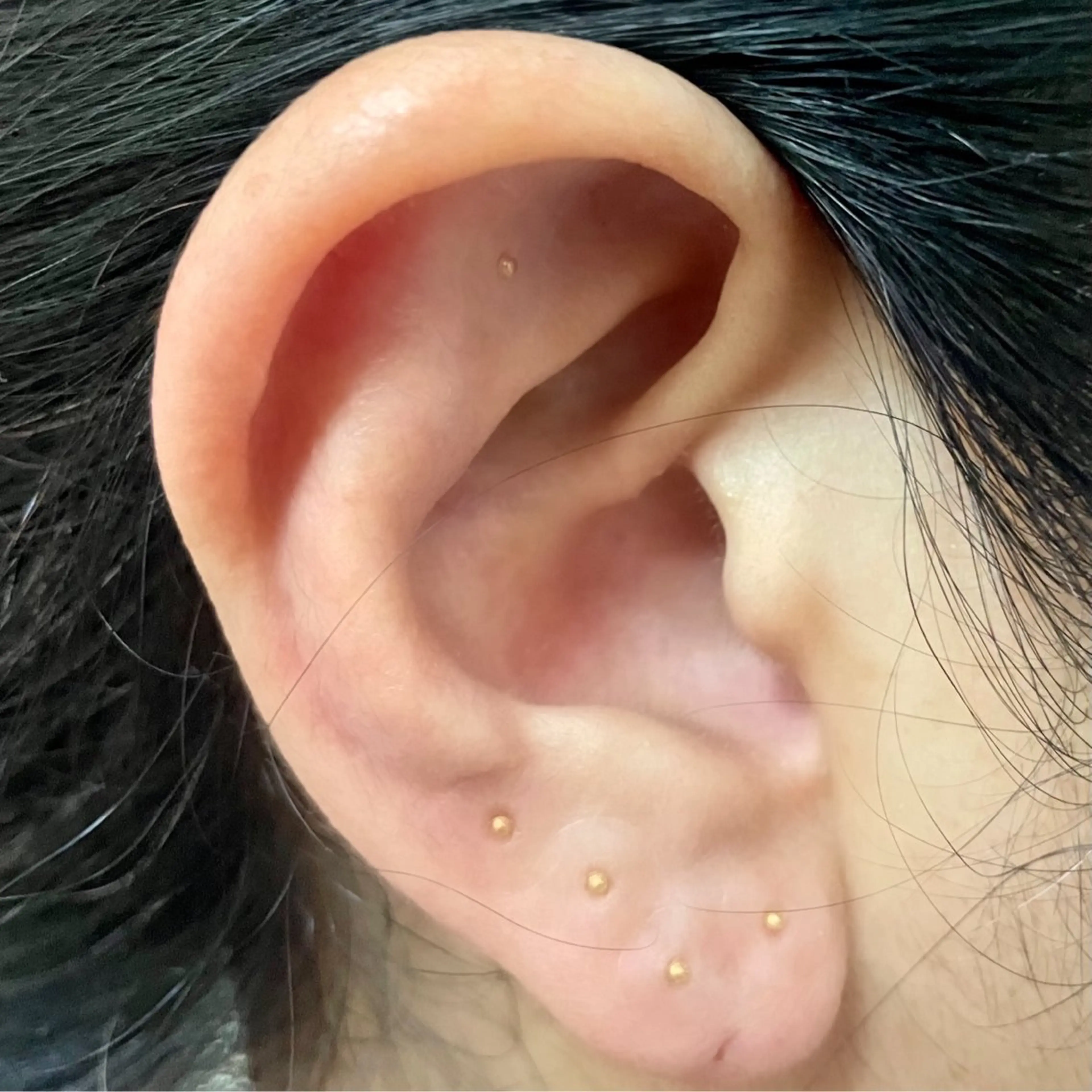 エステ リラク 肌質改善｜エステ Connect ゆいのエステ・リラクイメージ