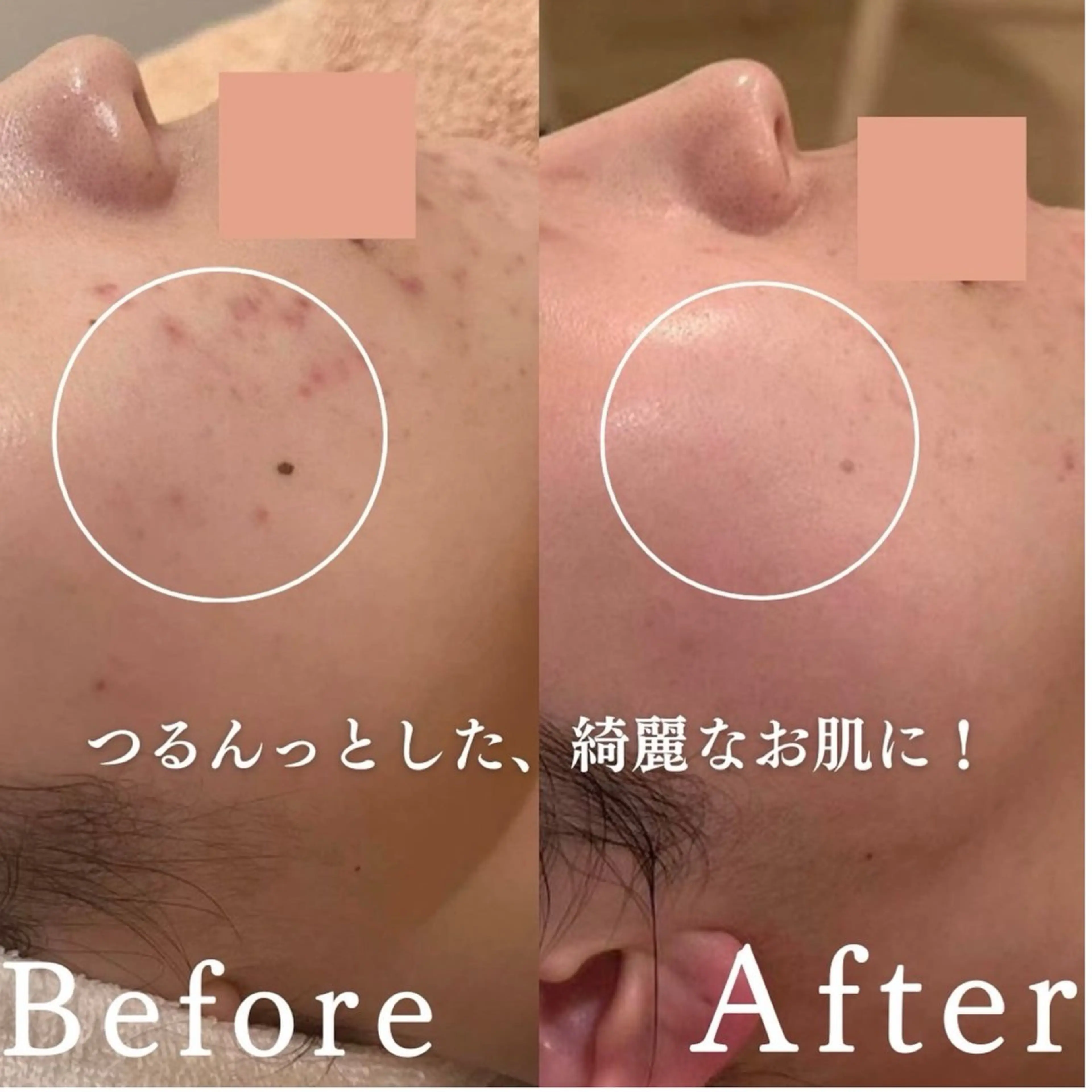 エステ 舟橋 優衣のエステ・リラクイメージ