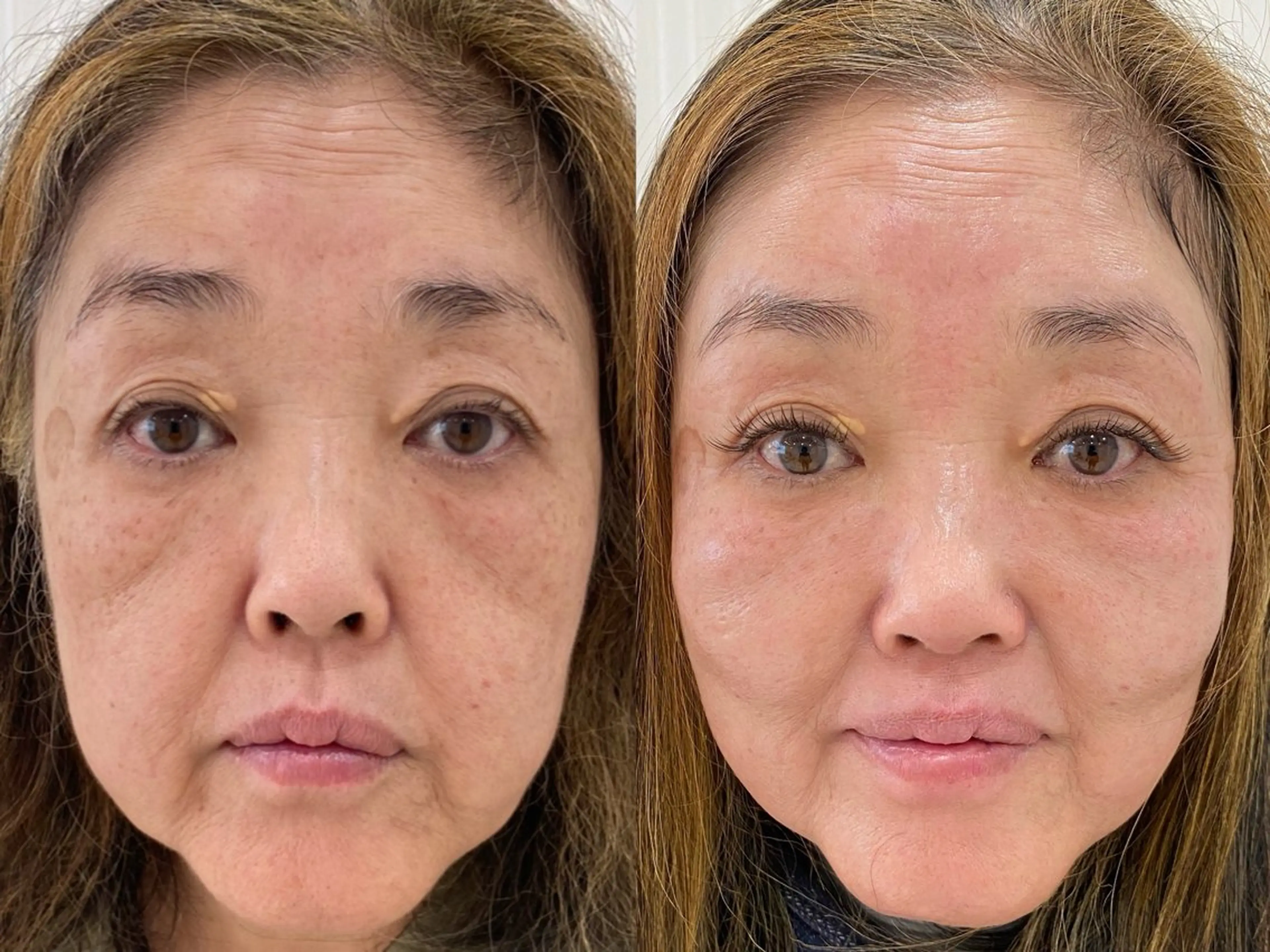 マツエク・マツパ Salon de Galcon 2階(サロンド・ギャルソン)所属・KU TA  \(◡̈)/のエステ・リラクイメージ